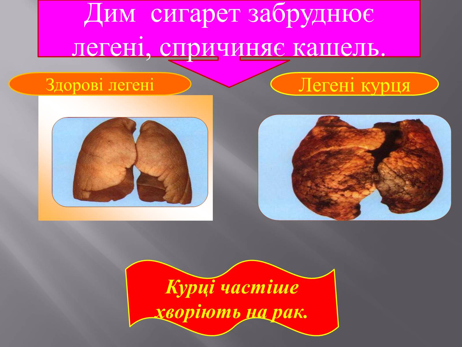 Презентація на тему «Вплив куріння, алкоголю на репродуктивне здоров&#8217;я» - Слайд #5