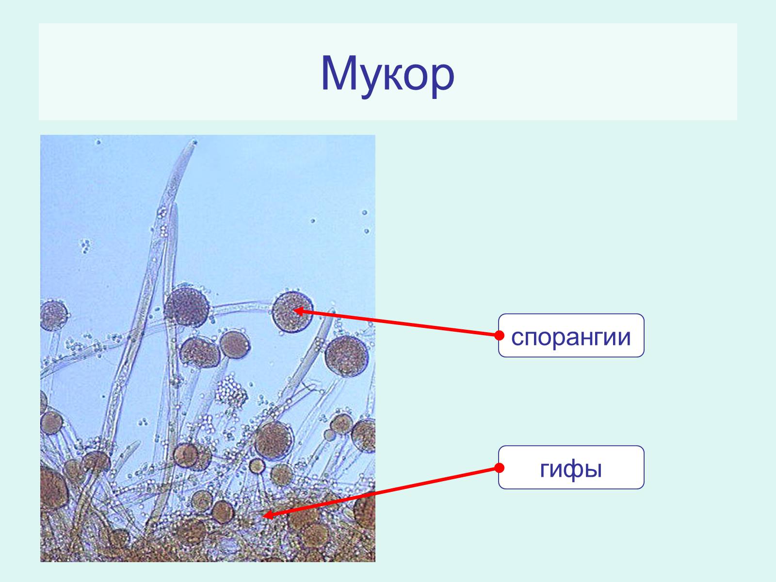 Мукор царство. Клетка гриба мукора под микроскопом. Плесень мукор под микроскопом строение. Гриб мукор строение под микроскопом. Мукор строение под микроскопом.