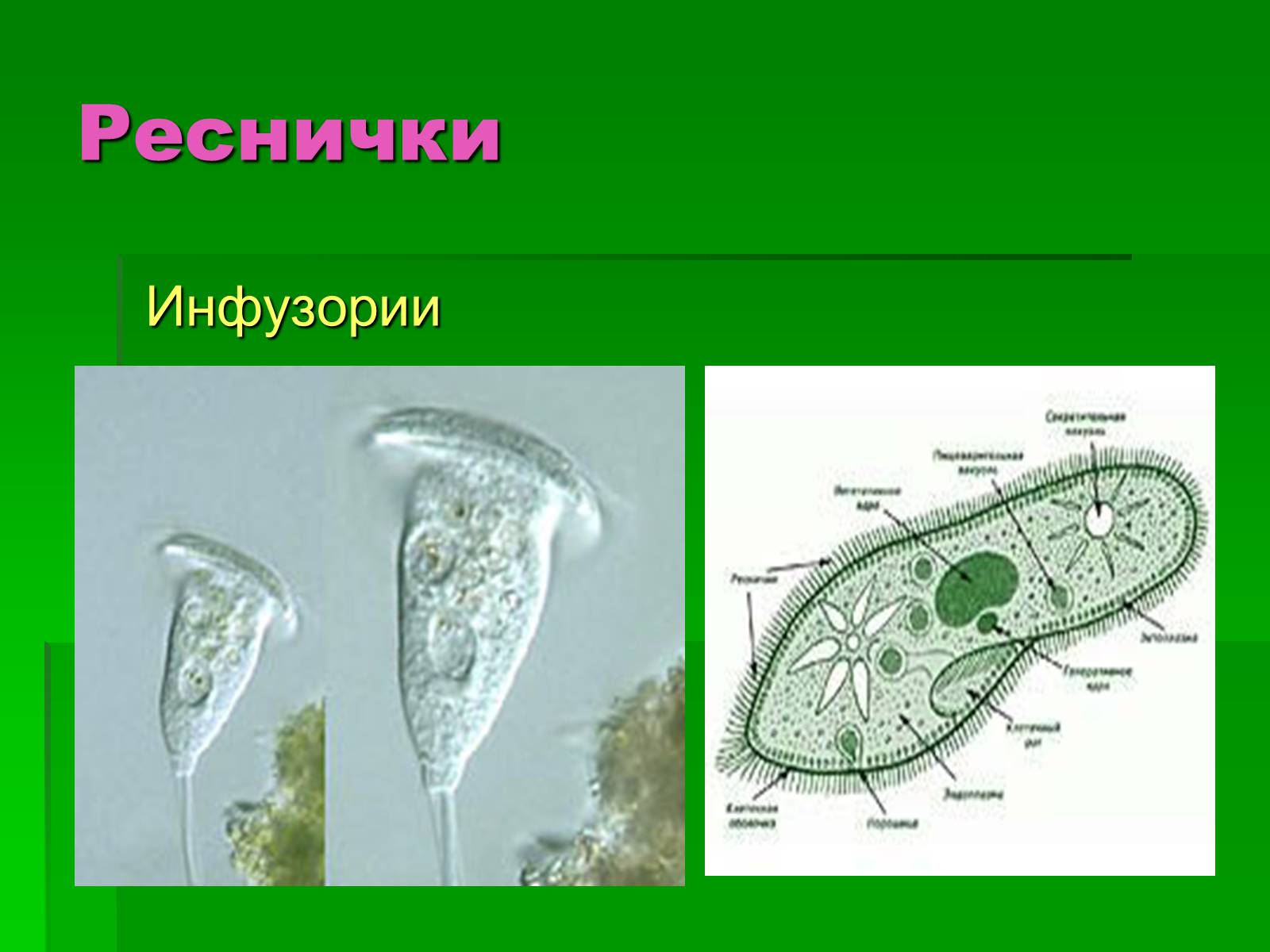 Презентація на тему «Подцарство Одноклеточные или Простейшие» - Слайд #11