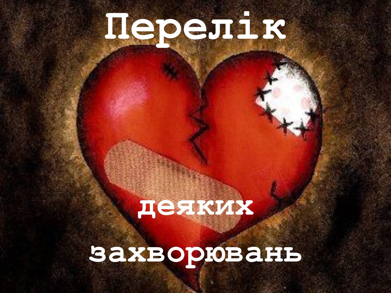 Презентація на тему «Захворювання серцево-судинної системи» (варіант 2) - Слайд #4