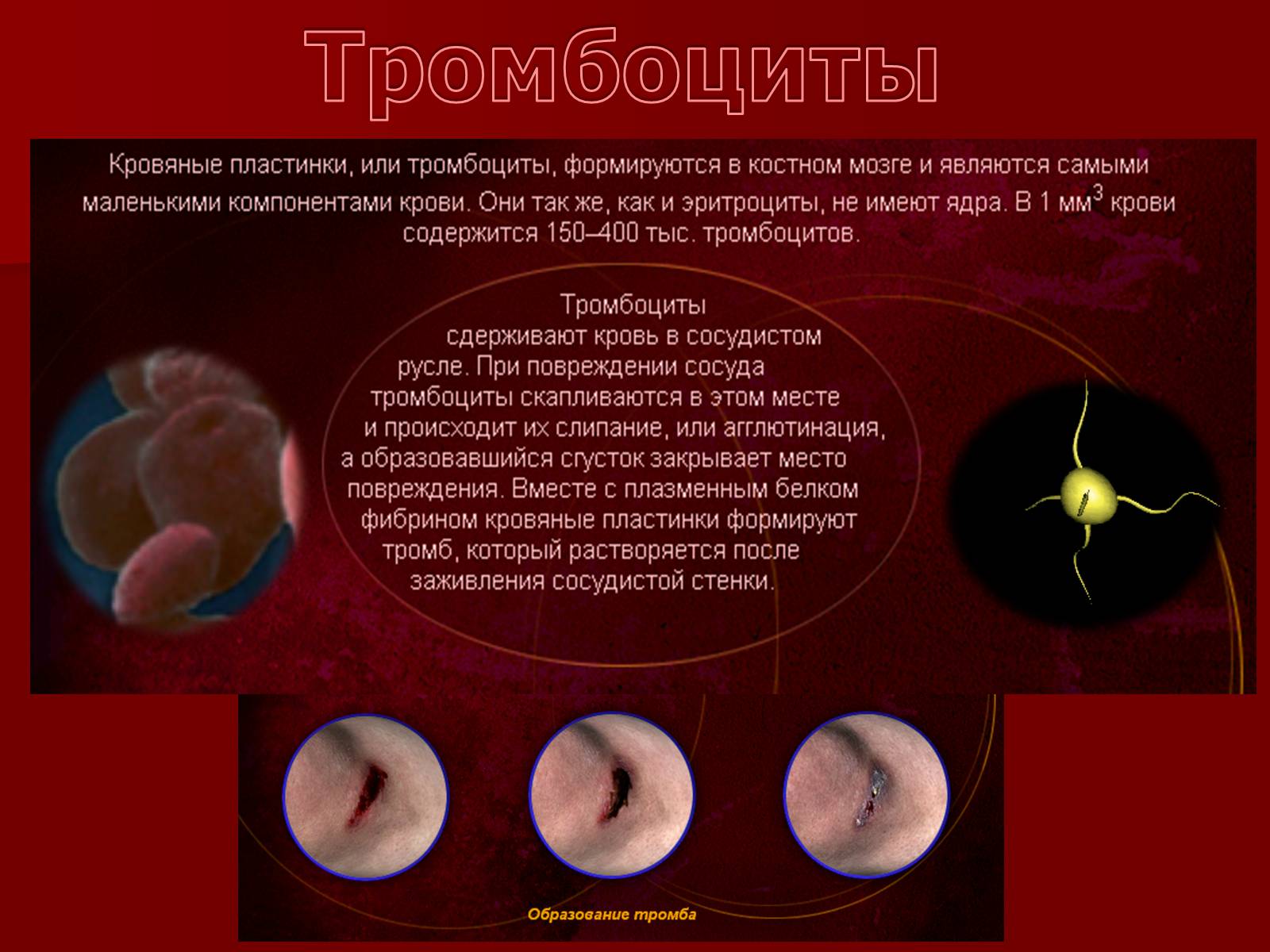 Низкие тромбоциты. Тромбоциты или кровяные пластинки. Кровяные пластинки крови. Маленькие кровяные пластинки. Красные кровяные пластинки.