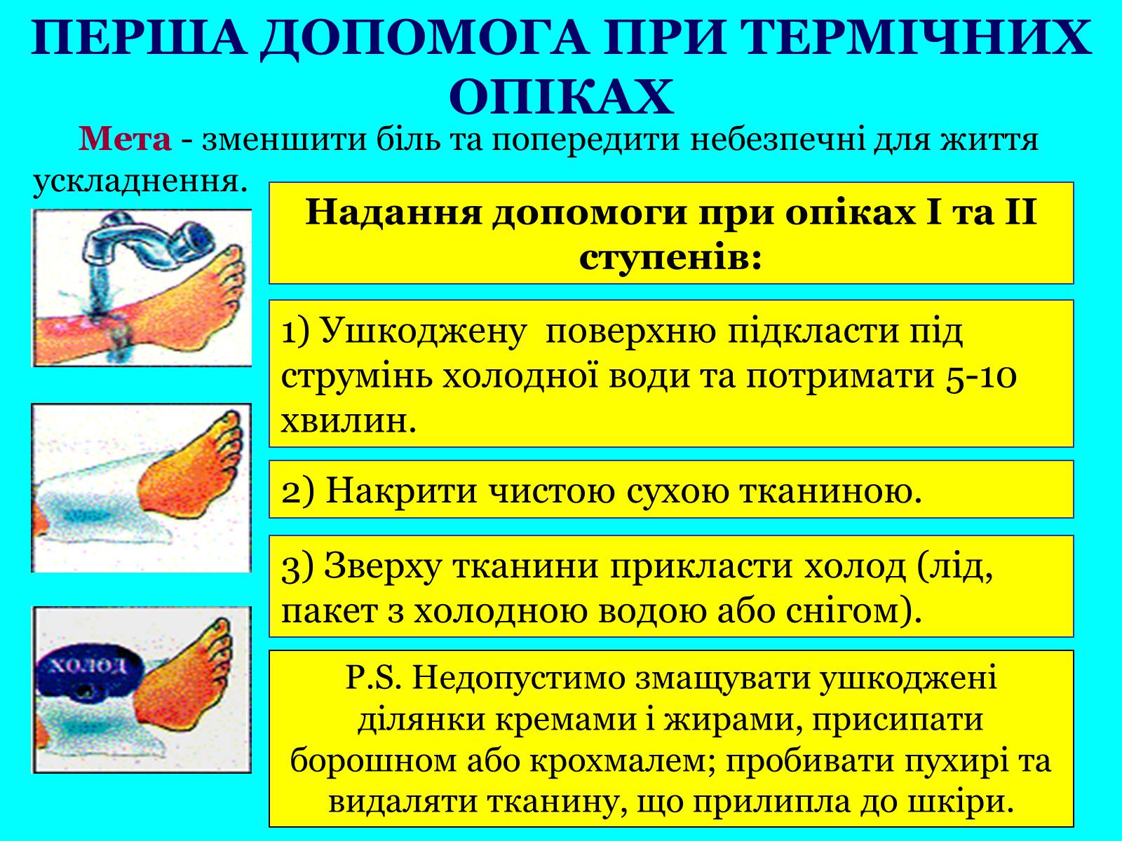 Презентація на тему «Опіки: види, причини, надання першої допомоги» - Слайд #11