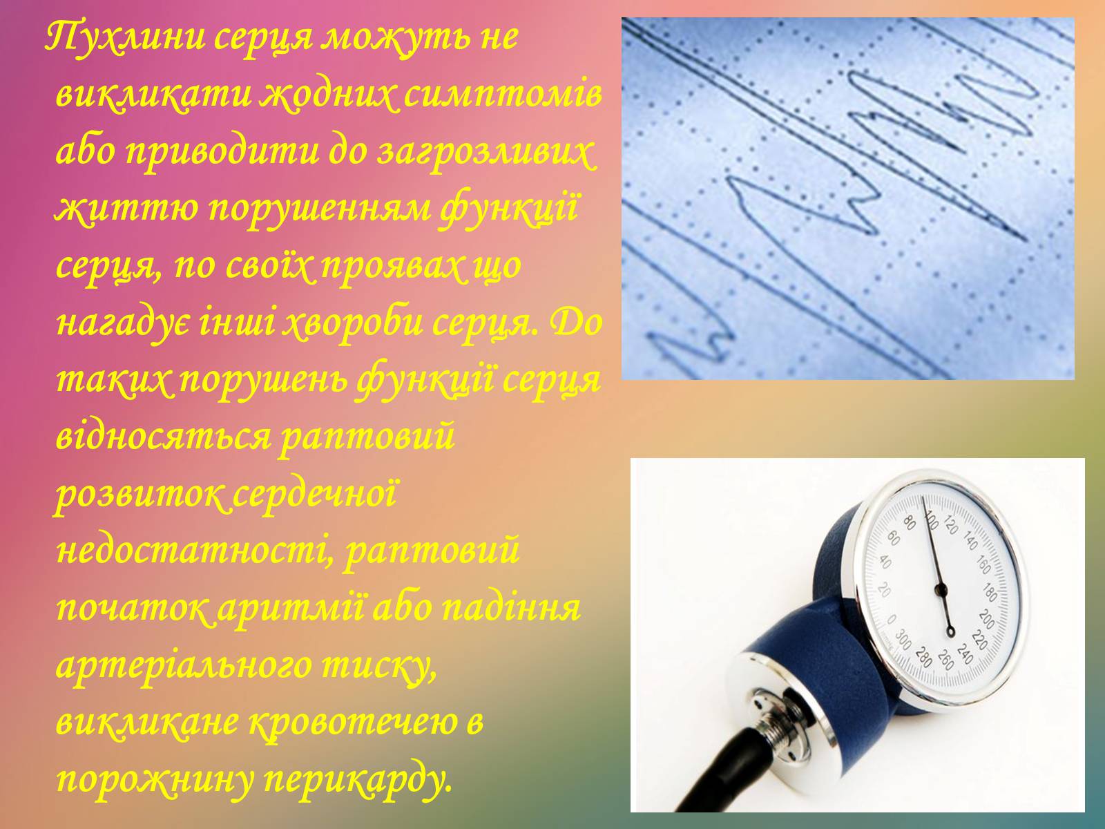 Презентація на тему «Захворювання органів кровообігу» - Слайд #21