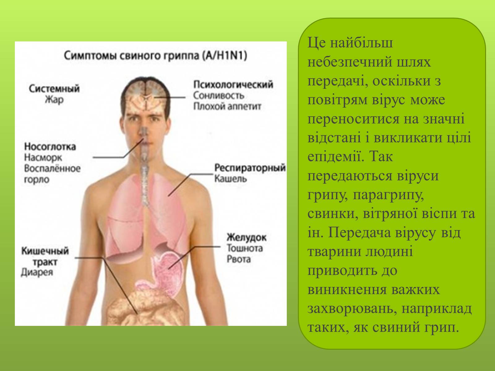 Свиной грипп симптомы. Грипп h1n1 симптомы. Свиной грипп симптомы у людей. Симптомы свиного гриппа у подростка. Свиной грипп симптомы у взрослых.