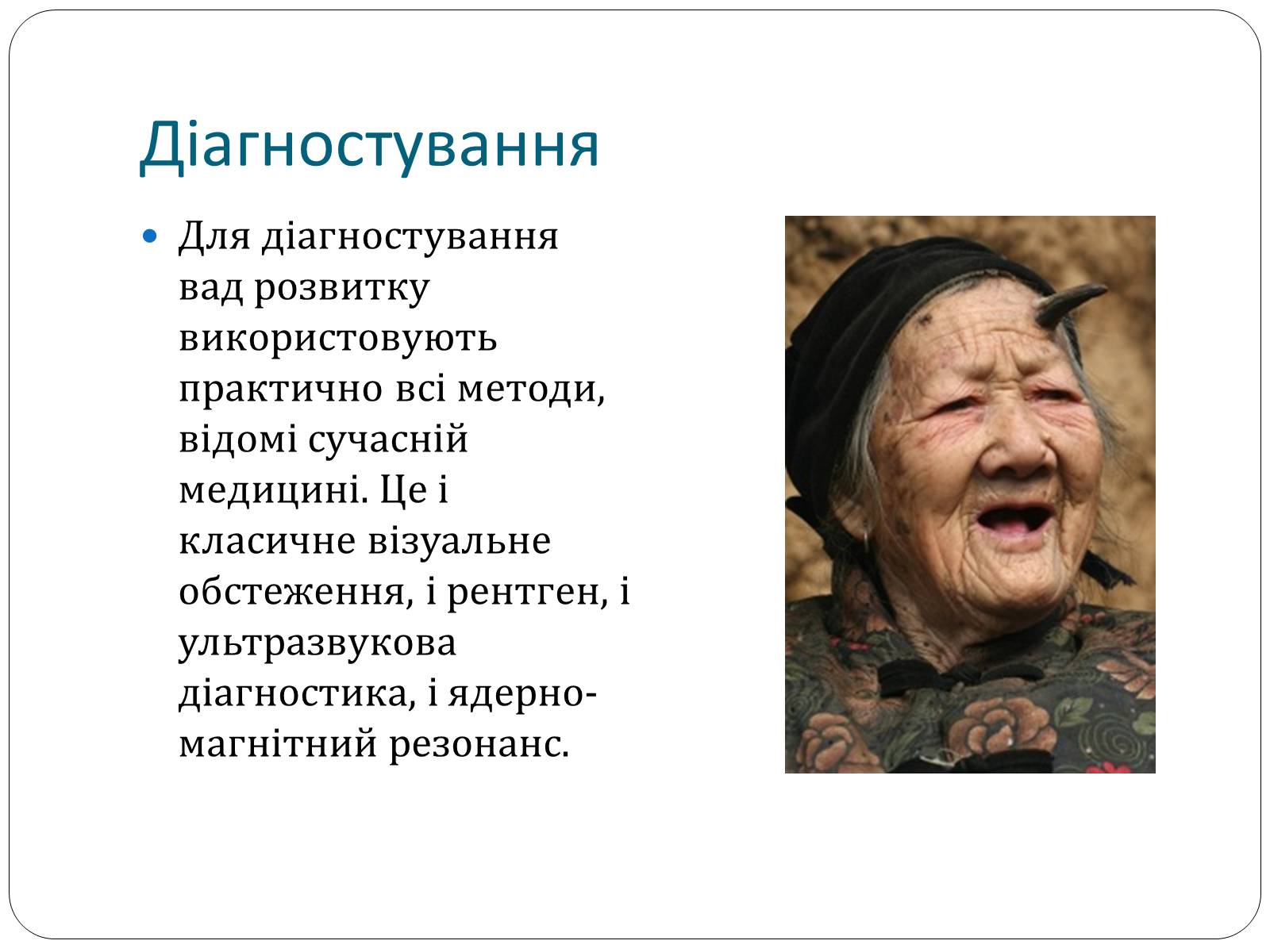 Презентація на тему «Діагностування вад розвитку людини» (варіант 1) - Слайд #8