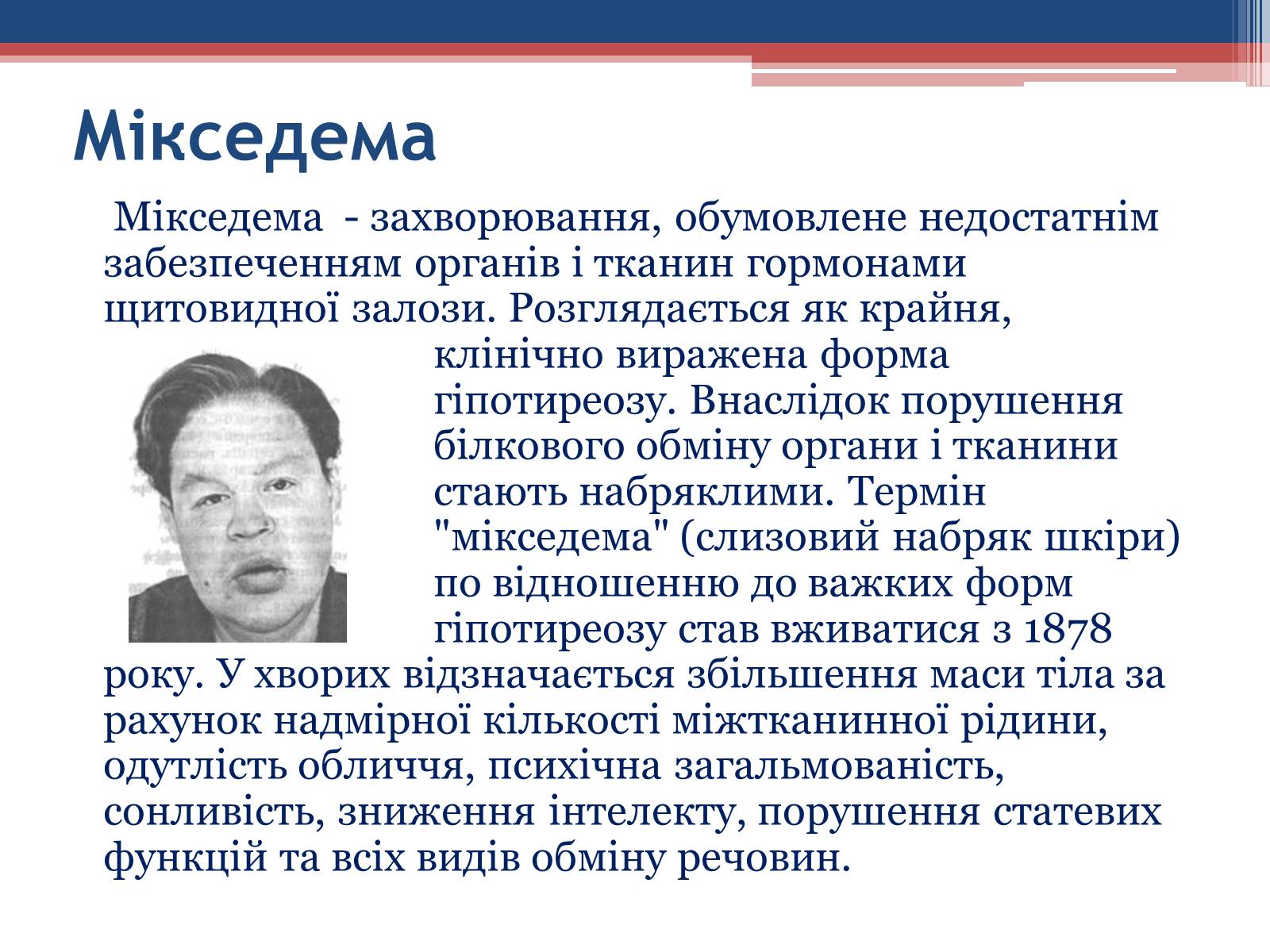 Презентація на тему «Порушення гормональних функцій ендокринних залоз» - Слайд #11