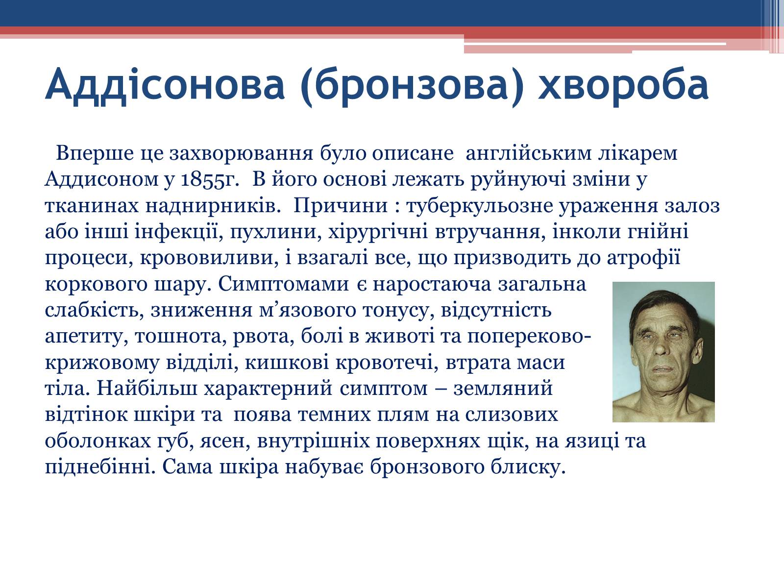 Презентація на тему «Порушення гормональних функцій ендокринних залоз» - Слайд #14