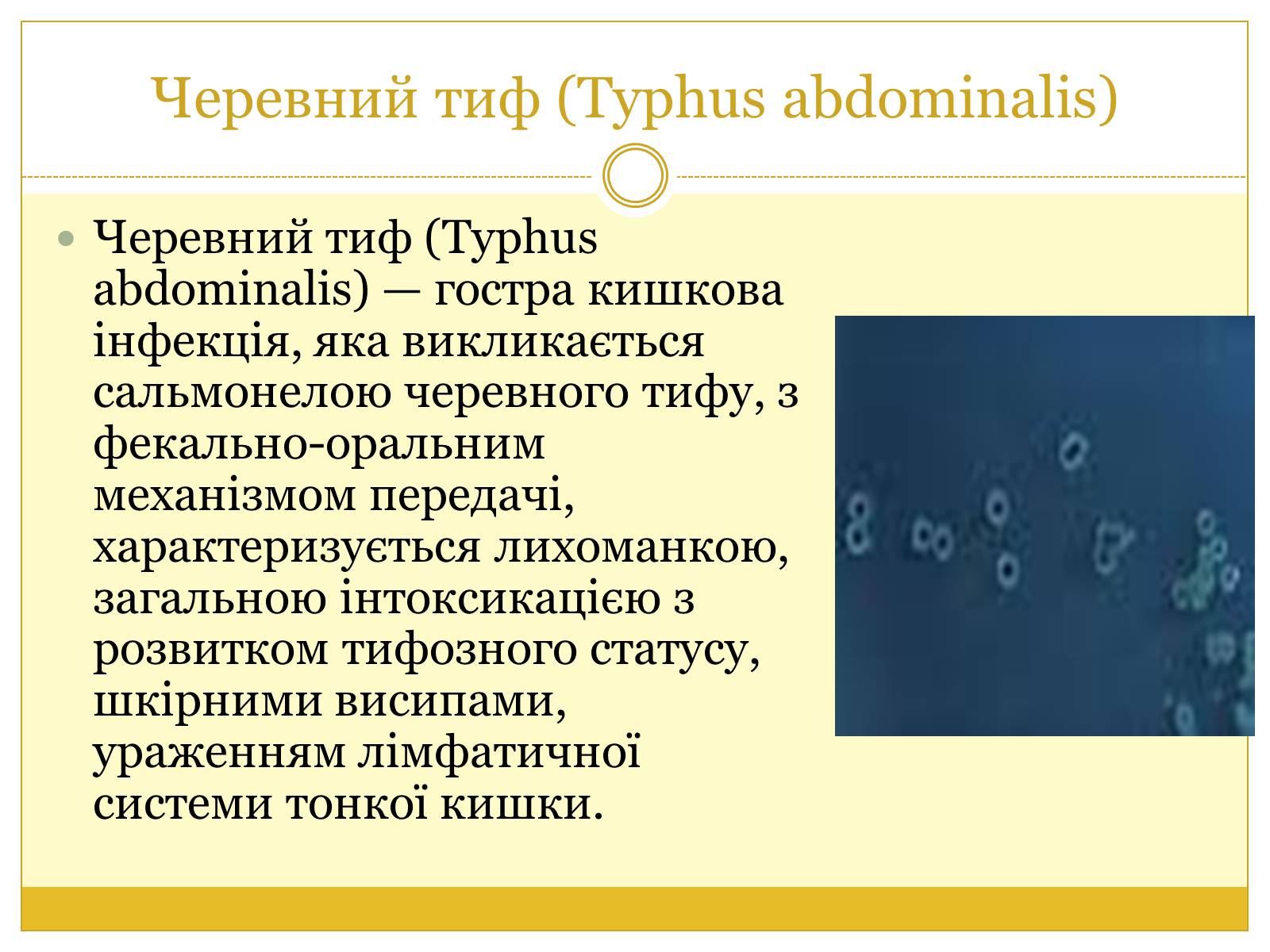 Презентація на тему «Бактерії та здоров&#8217;я людини» - Слайд #4