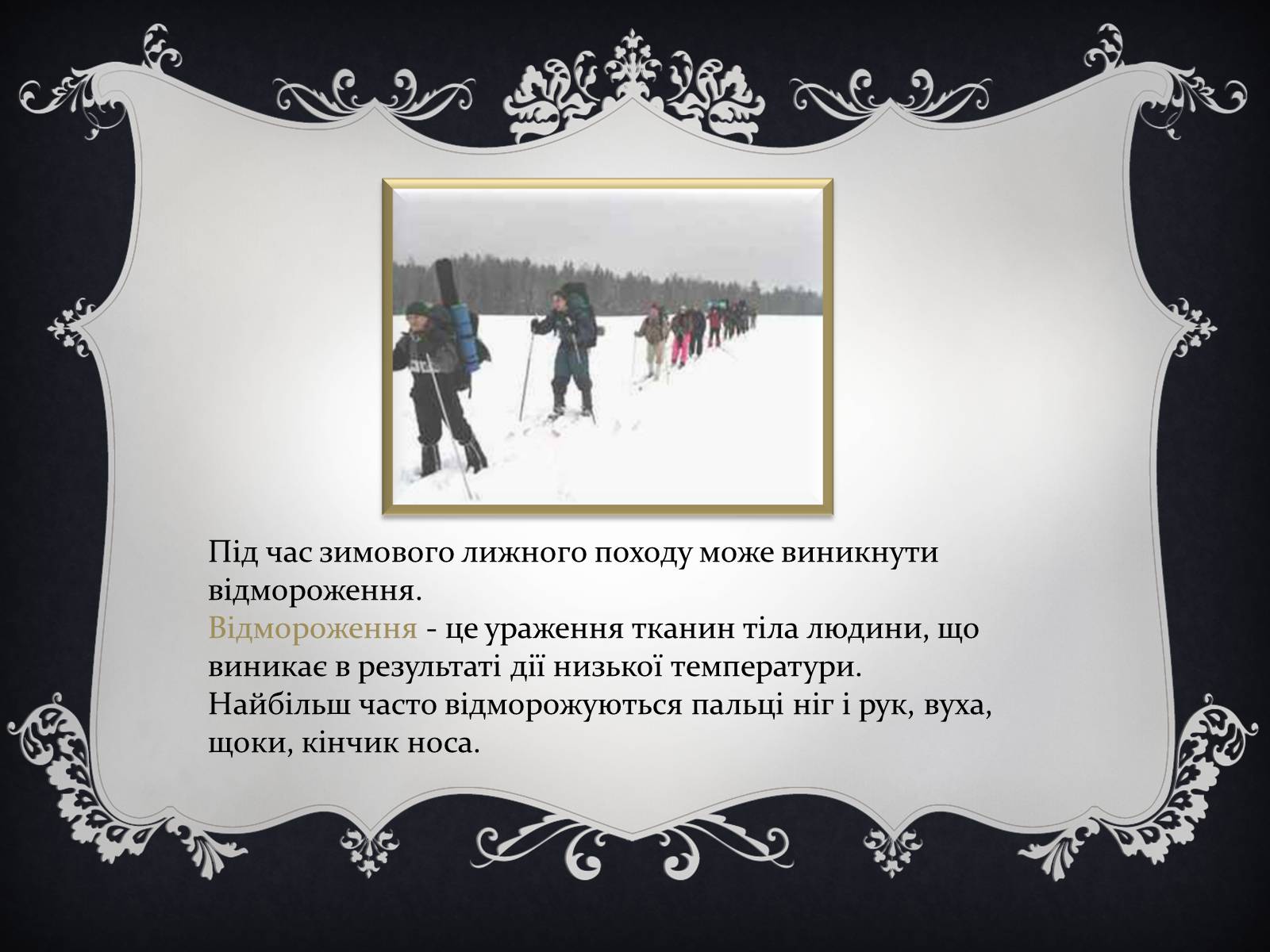 Презентація на тему «Надання першої медичної допомоги притепловомута сонячному ударах, обмороженні та опіках» - Слайд #14