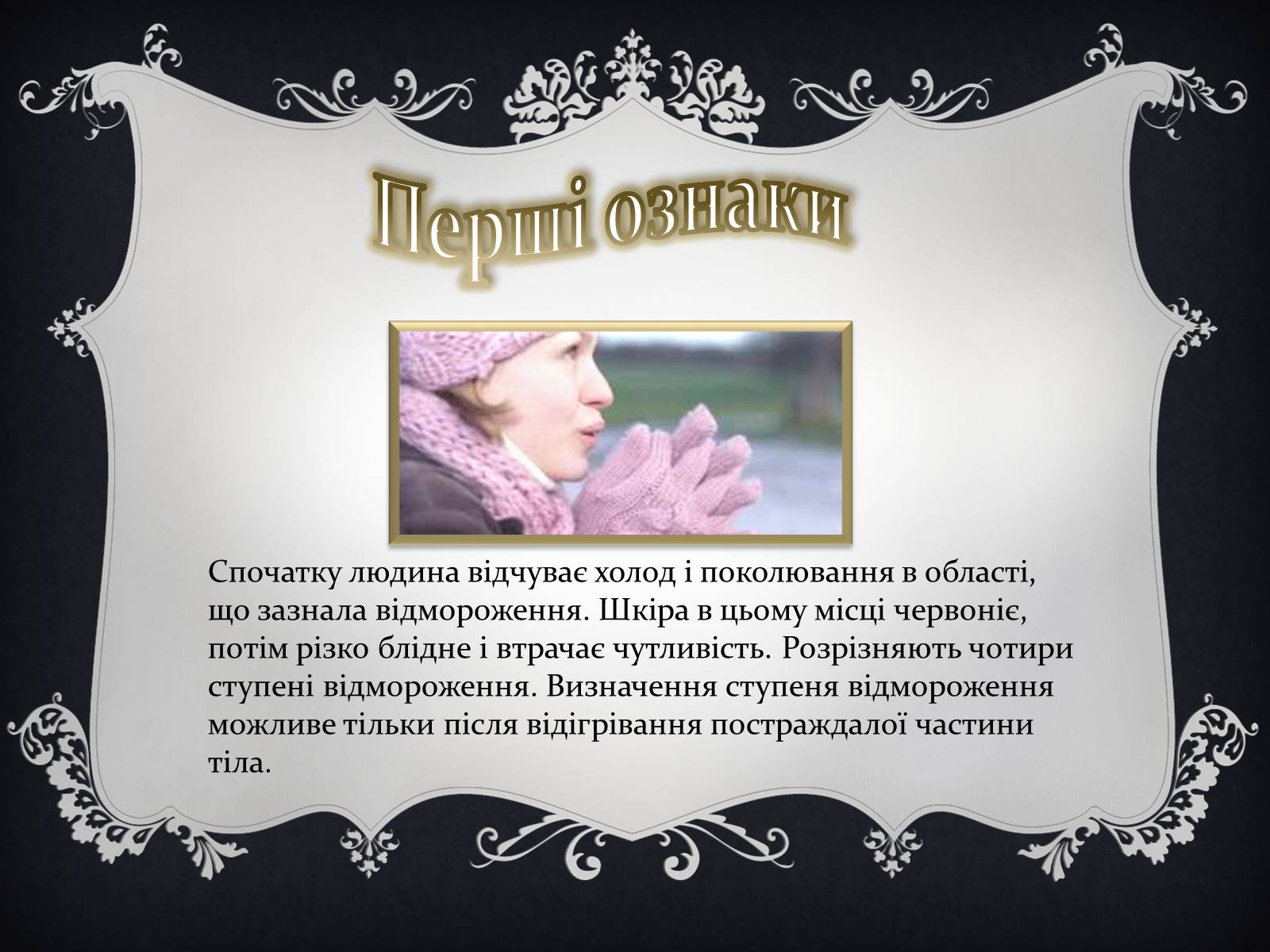 Презентація на тему «Надання першої медичної допомоги притепловомута сонячному ударах, обмороженні та опіках» - Слайд #15