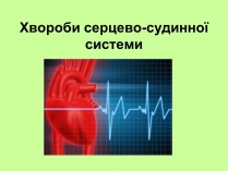 Презентація на тему «Хвороби серцево-судинної системи» (варіант 1)