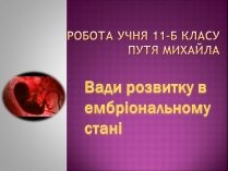 Презентація на тему «Вади розвитку в ембріональному стані»