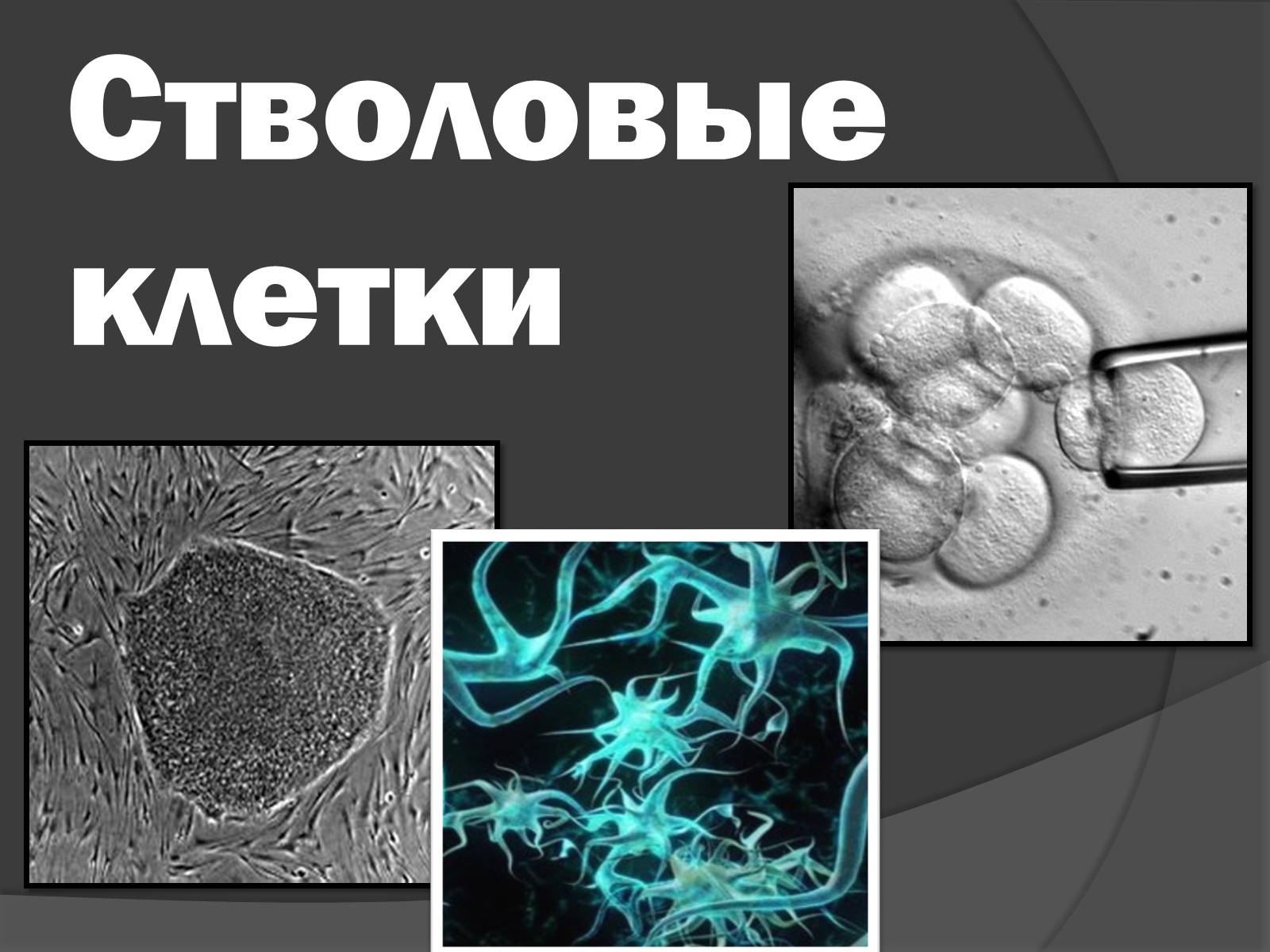 Стволовые клетки это. Стволовые клетки презентация. Эмбриональные стволовые клетки презентация. Стромальные клетки. Презентация на тему стволовые клетки.