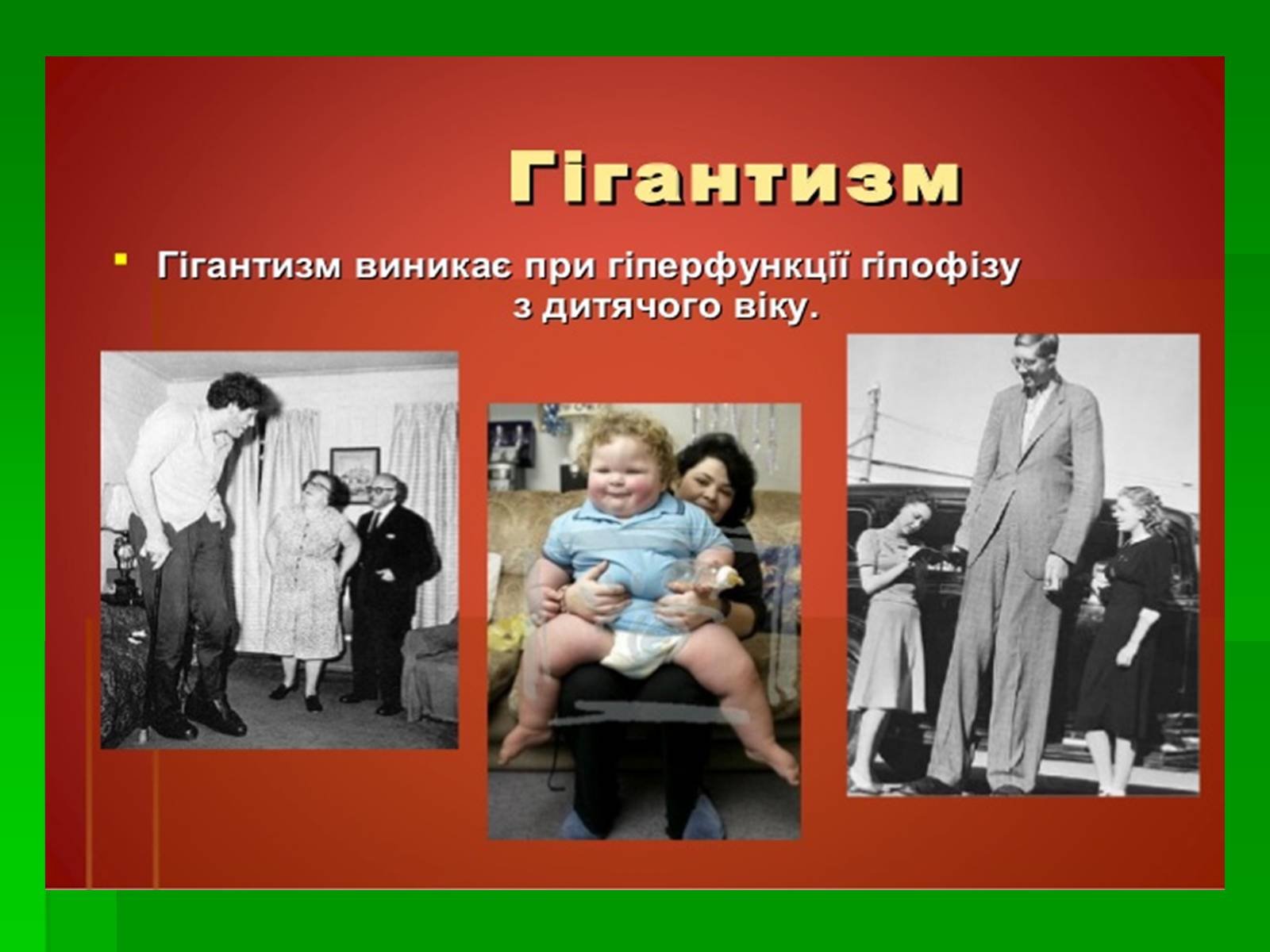 Презентація на тему «Захворювання залоз внутрішньої секреції» - Слайд #2