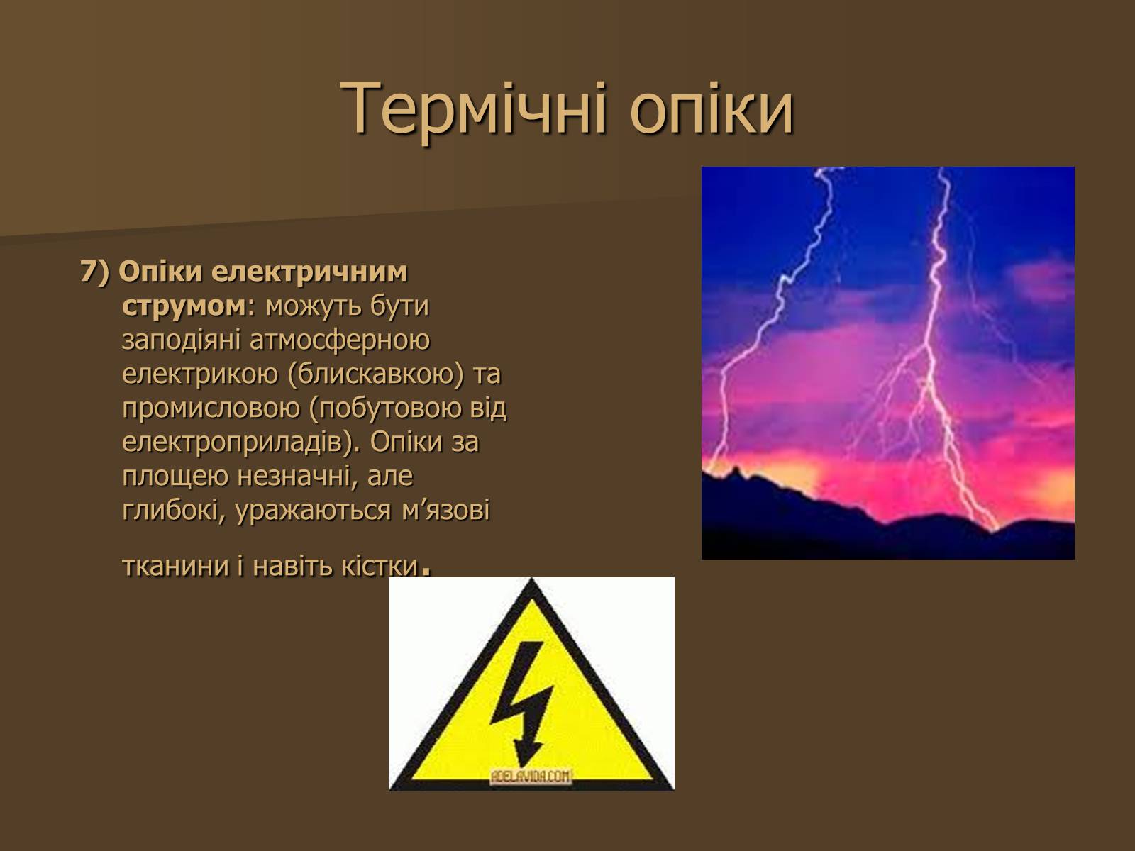 Презентація на тему «Опіки» (варіант 3) - Слайд #5