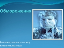 Презентація на тему «Обмороження» (варіант 3)