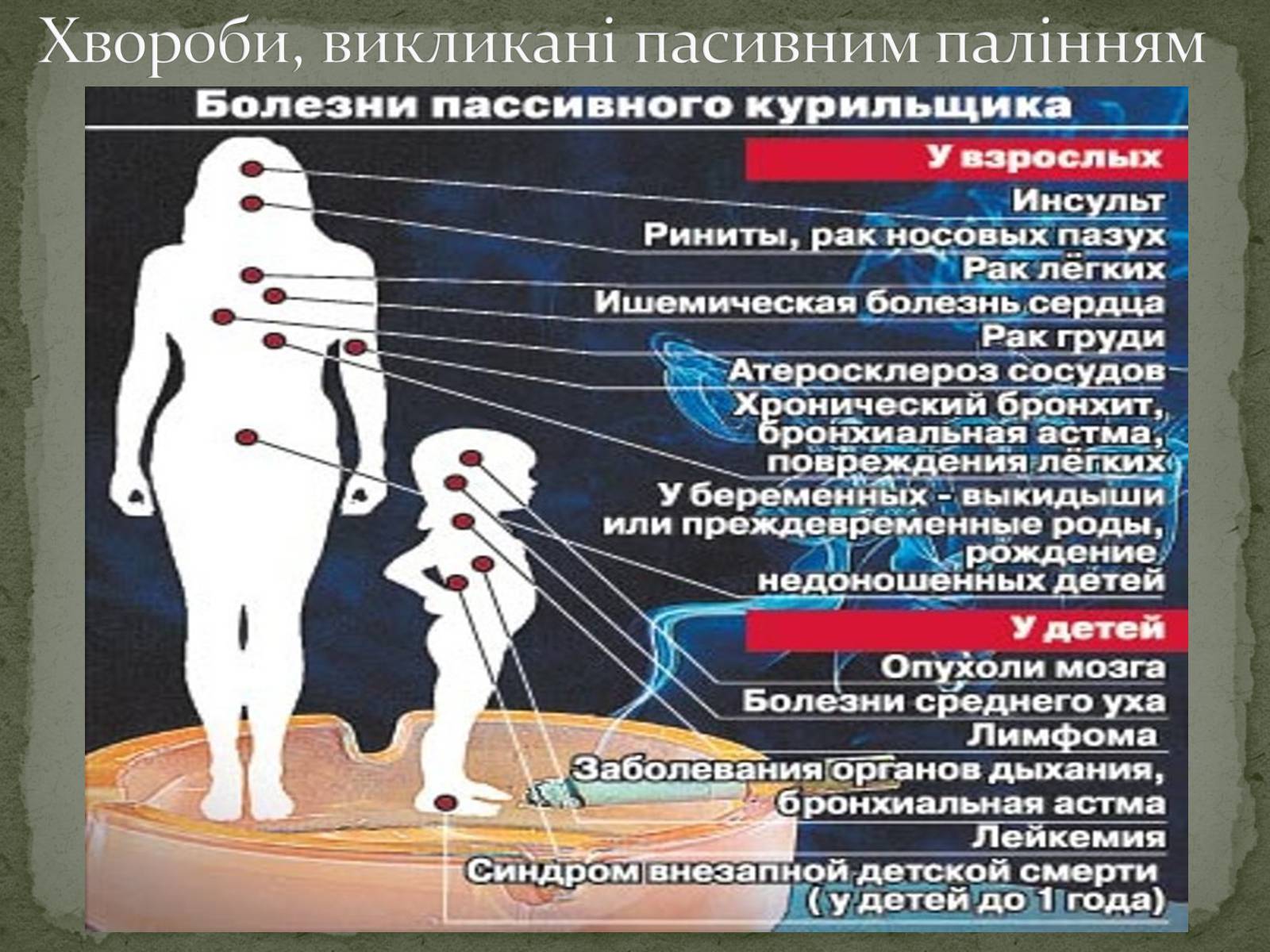 Презентація на тему «Тютюнопаління» (варіант 5) - Слайд #25