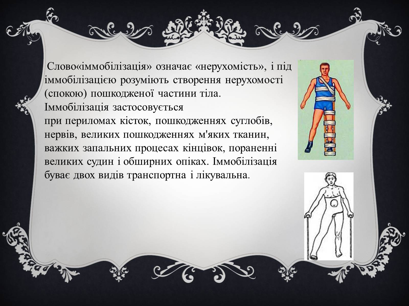 Презентація на тему «Іммобілізація пошкодженої ділянки тіла людини» - Слайд #3