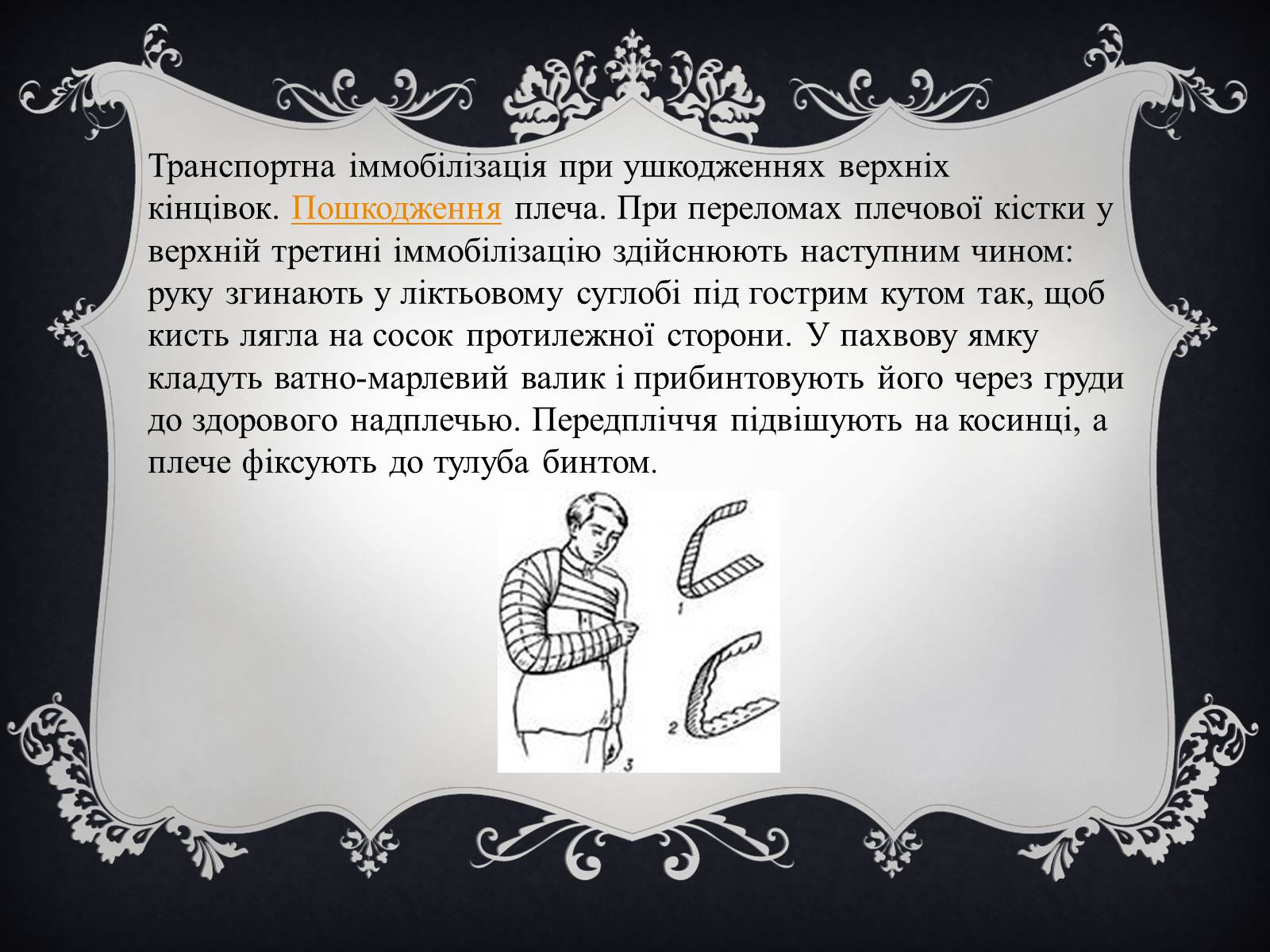 Презентація на тему «Іммобілізація пошкодженої ділянки тіла людини» - Слайд #9