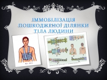 Презентація на тему «Іммобілізація пошкодженої ділянки тіла людини»