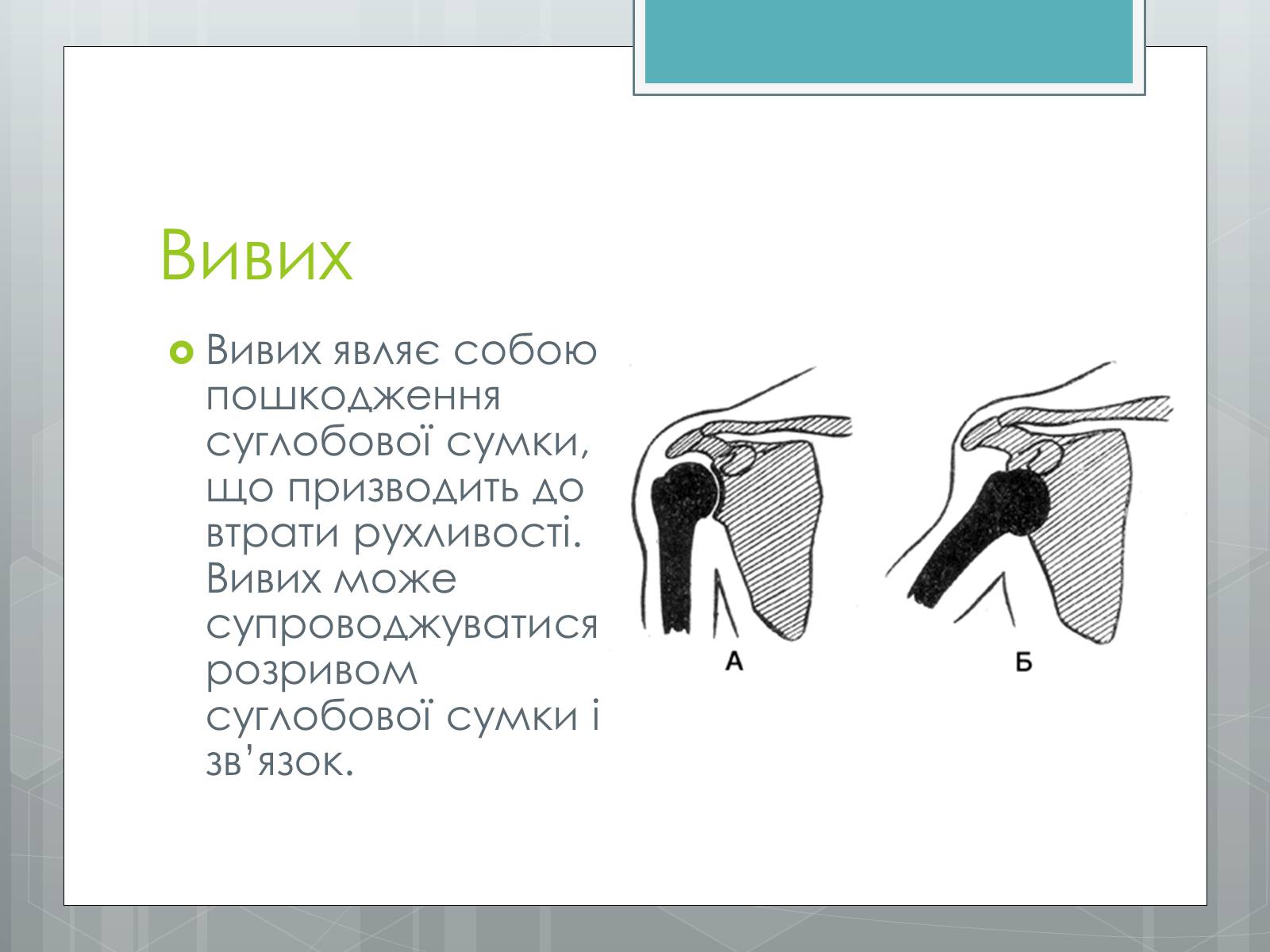 Презентація на тему «Вивихи, удари, розтягнення» - Слайд #2