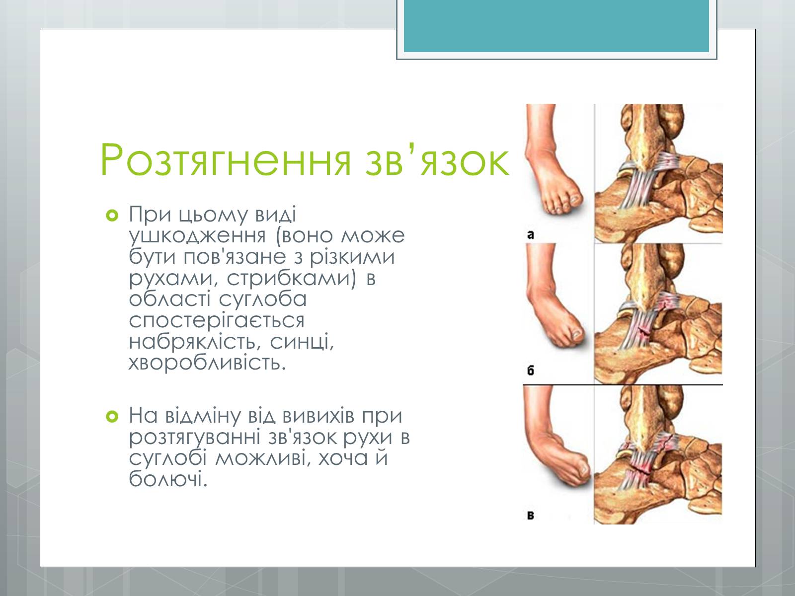 Презентація на тему «Вивихи, удари, розтягнення» - Слайд #5