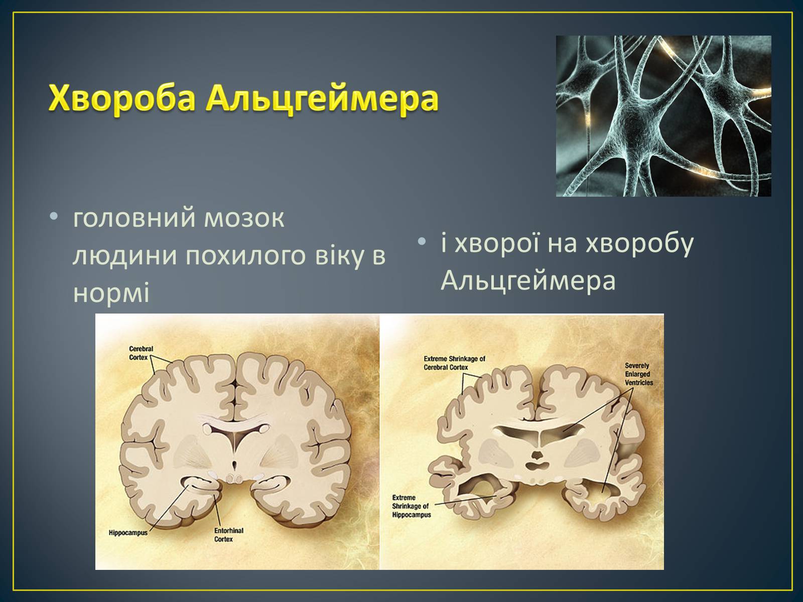 Презентація на тему «Типи генетичних хвороб людини» (варіант 2) - Слайд #11