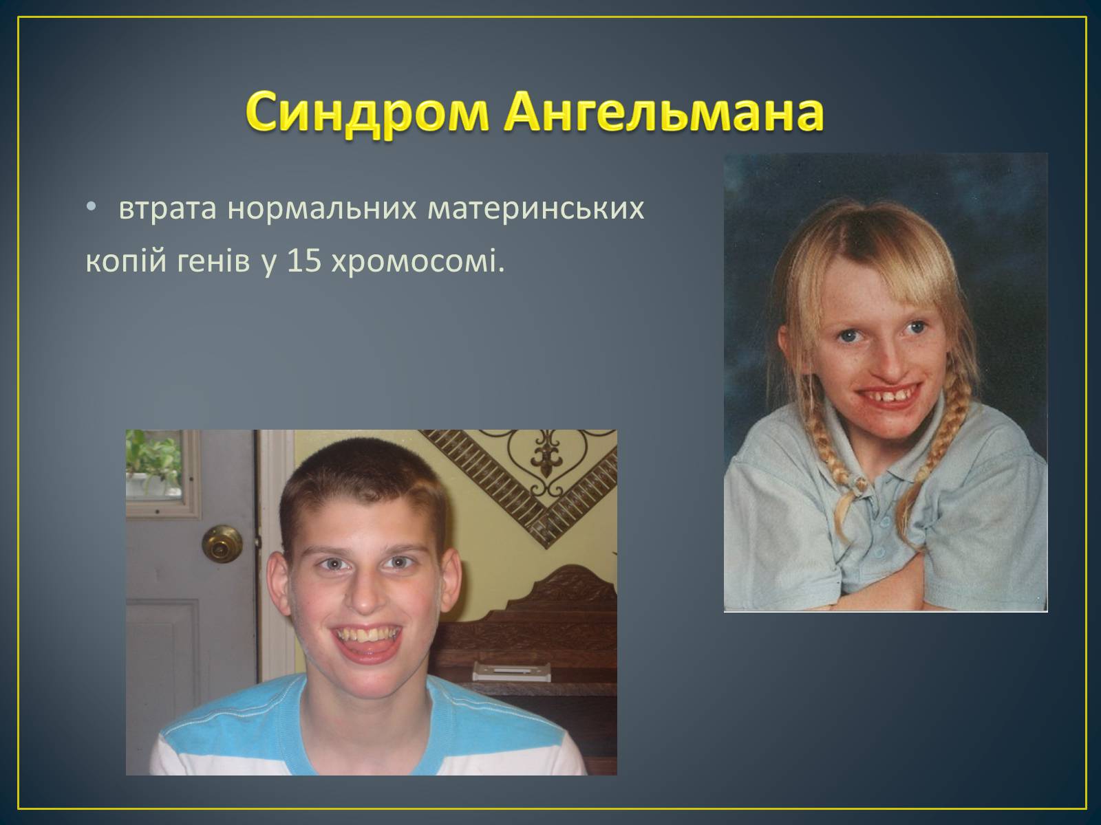 Презентація на тему «Типи генетичних хвороб людини» (варіант 2) - Слайд #17