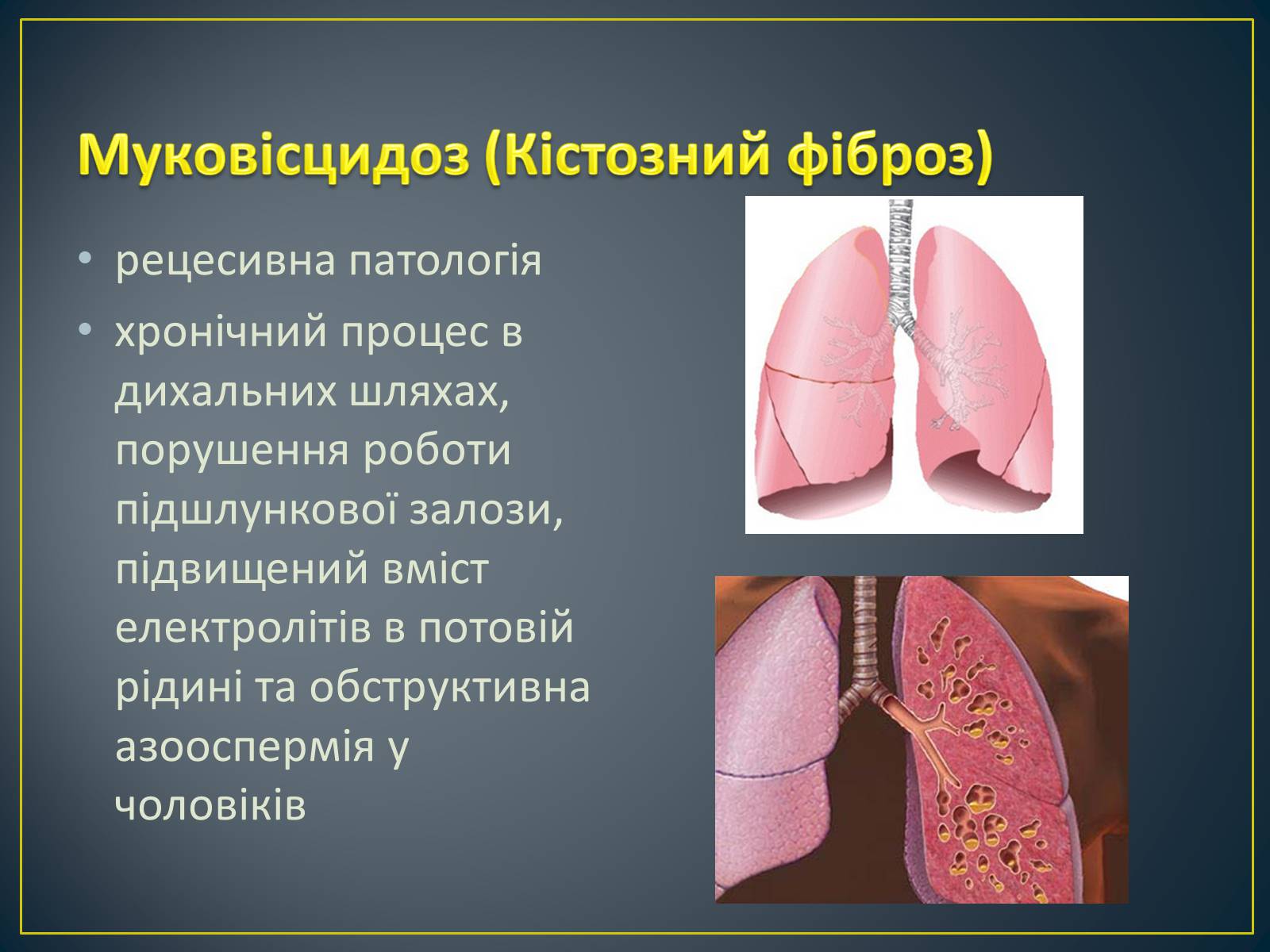 Презентація на тему «Типи генетичних хвороб людини» (варіант 2) - Слайд #3