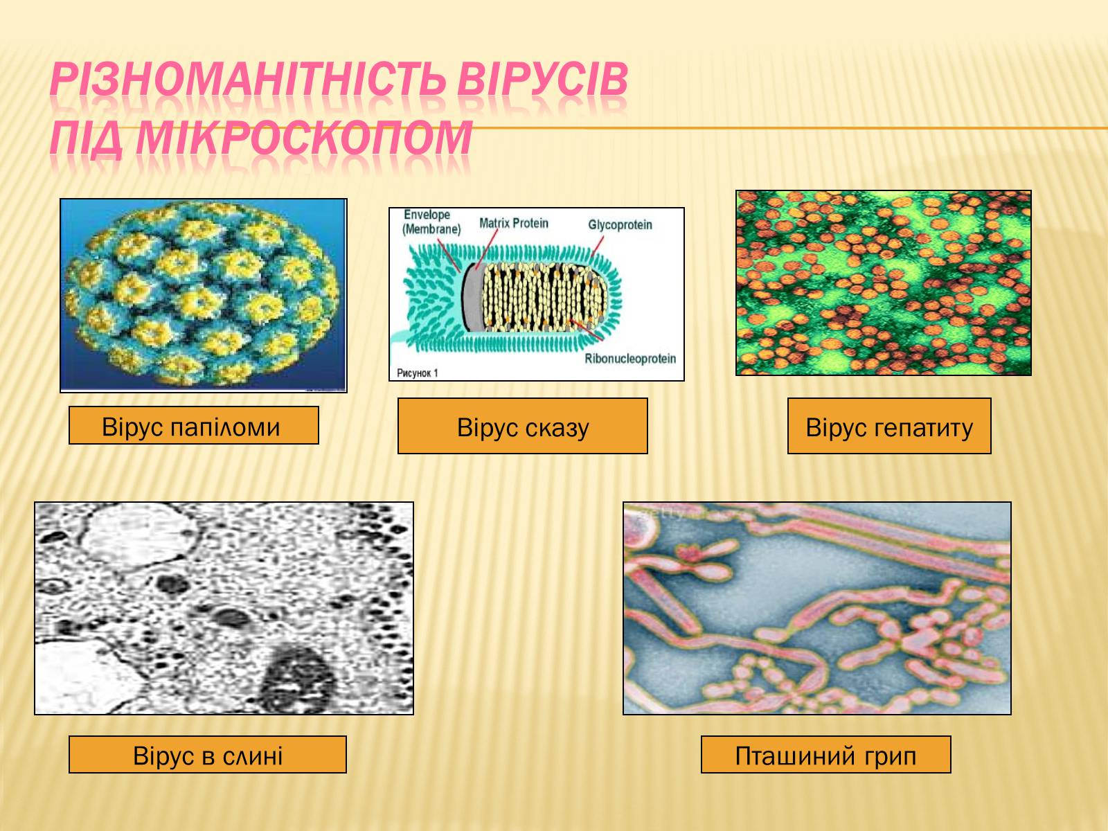 Презентація на тему «Віруси» (варіант 12) - Слайд #6