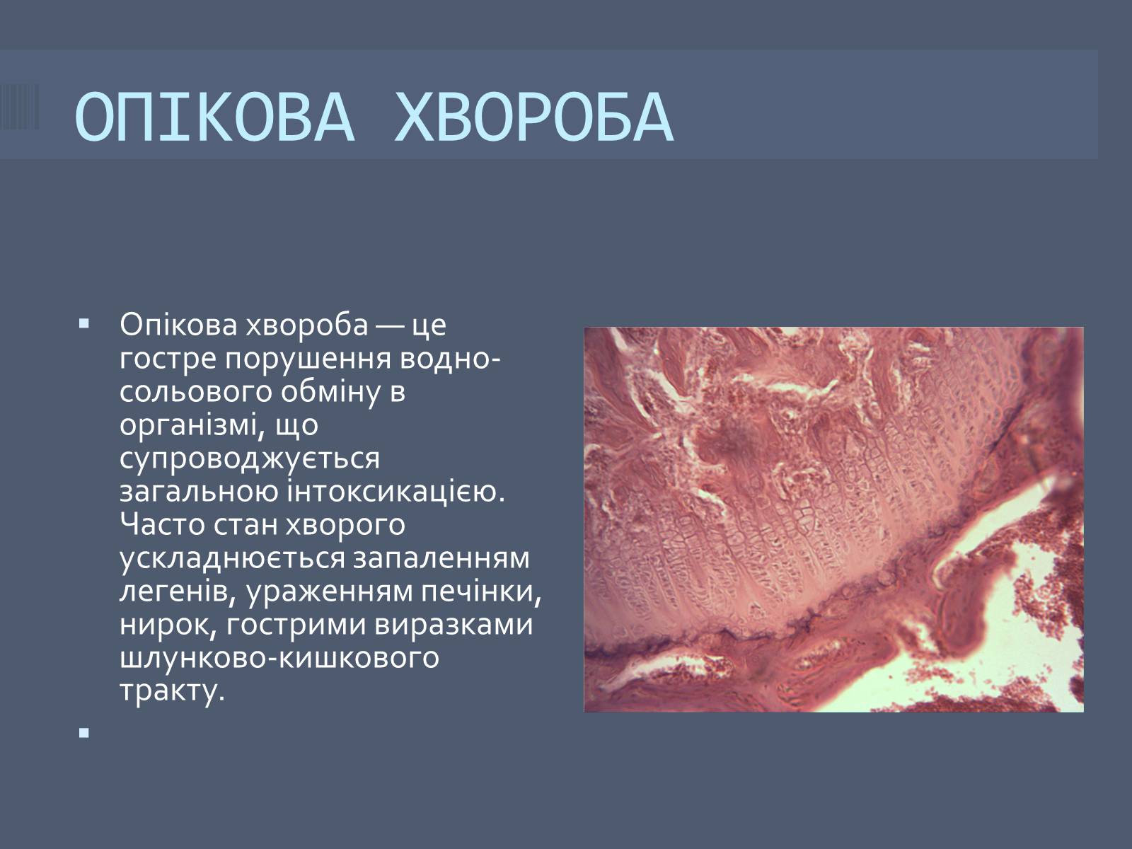 Презентація на тему «Класифікація опіків» - Слайд #5