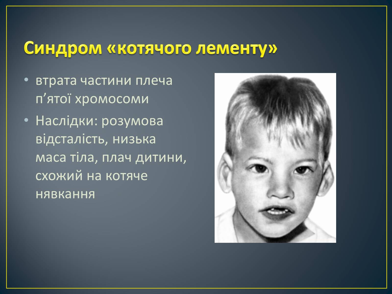 Презентація на тему «Типи генетичних хвороб людини» (варіант 1) - Слайд #14