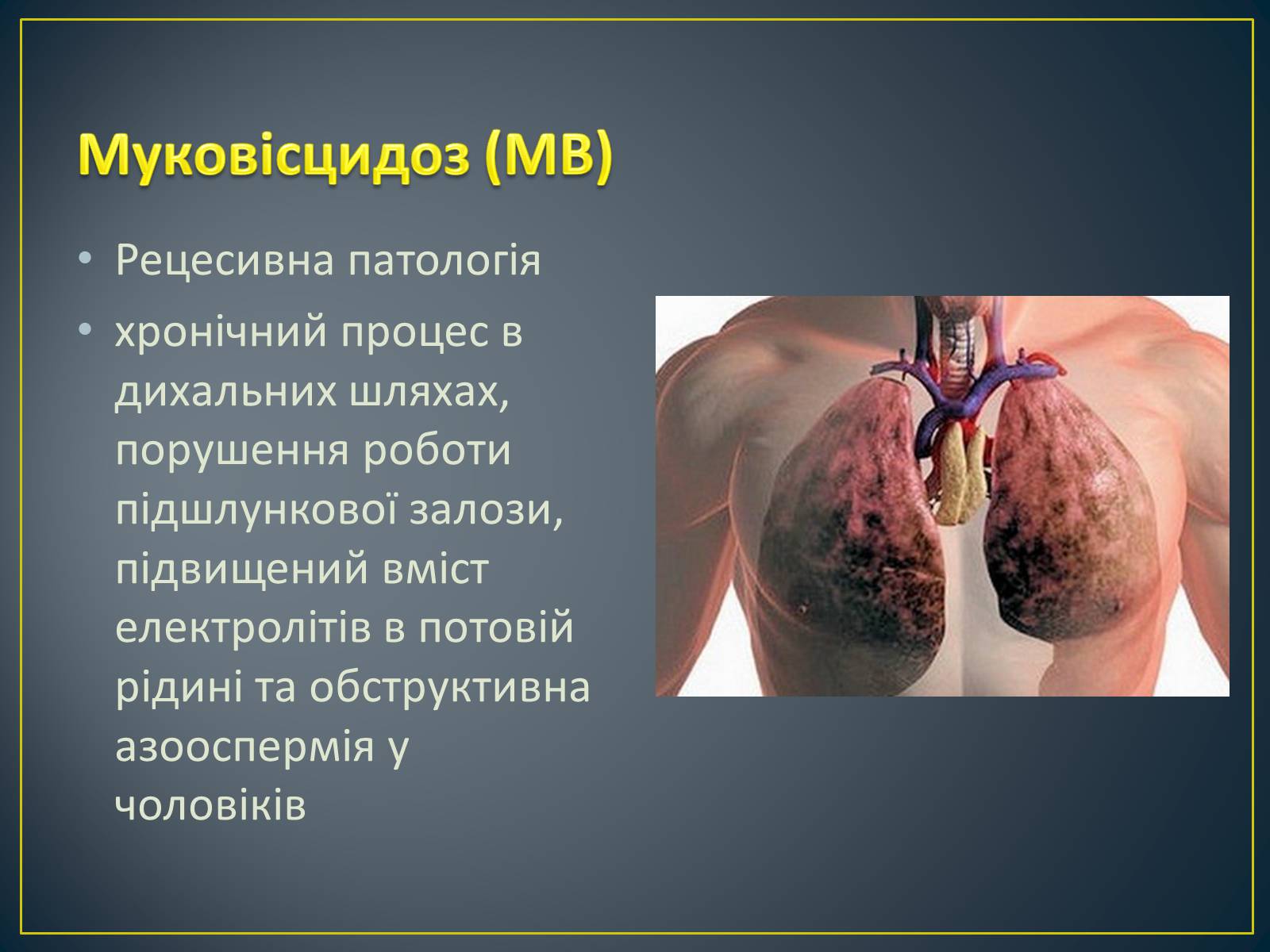 Презентація на тему «Типи генетичних хвороб людини» (варіант 1) - Слайд #3