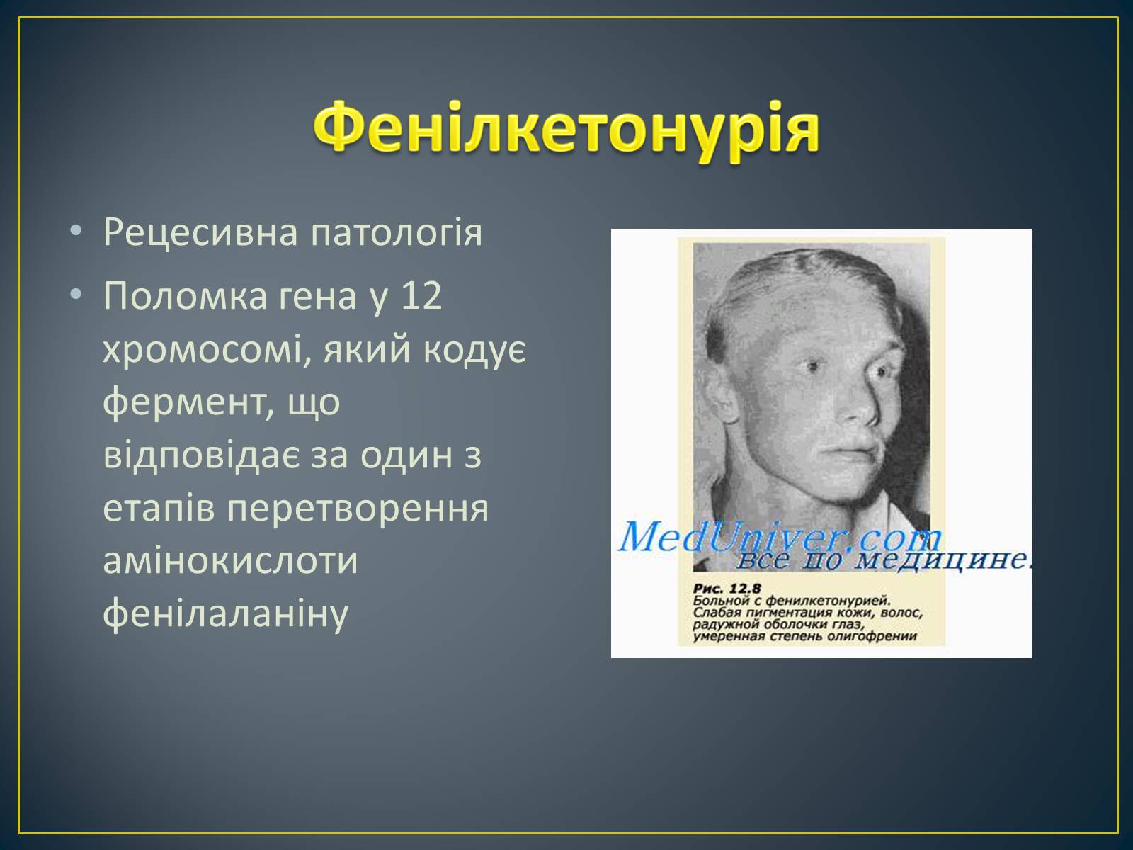 Презентація на тему «Типи генетичних хвороб людини» (варіант 1) - Слайд #7