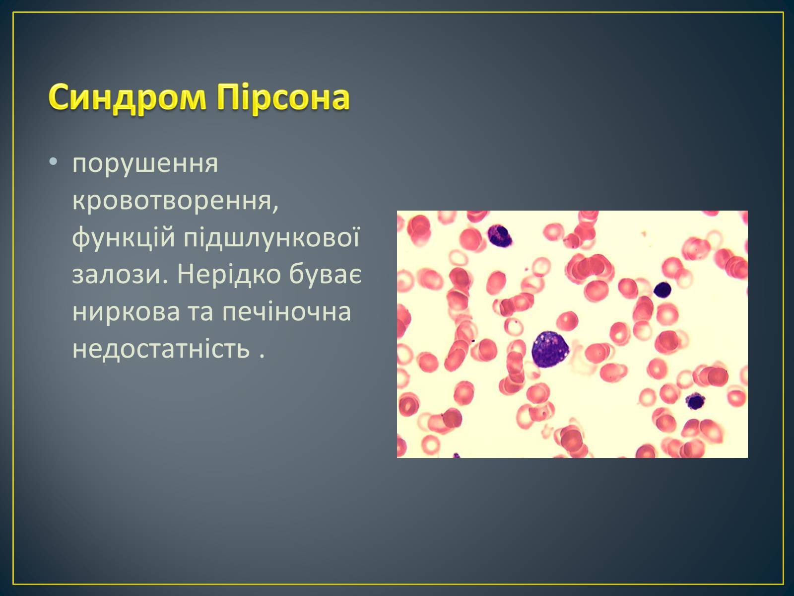 Презентація на тему «Типи генетичних хвороб людини» (варіант 3) - Слайд #20