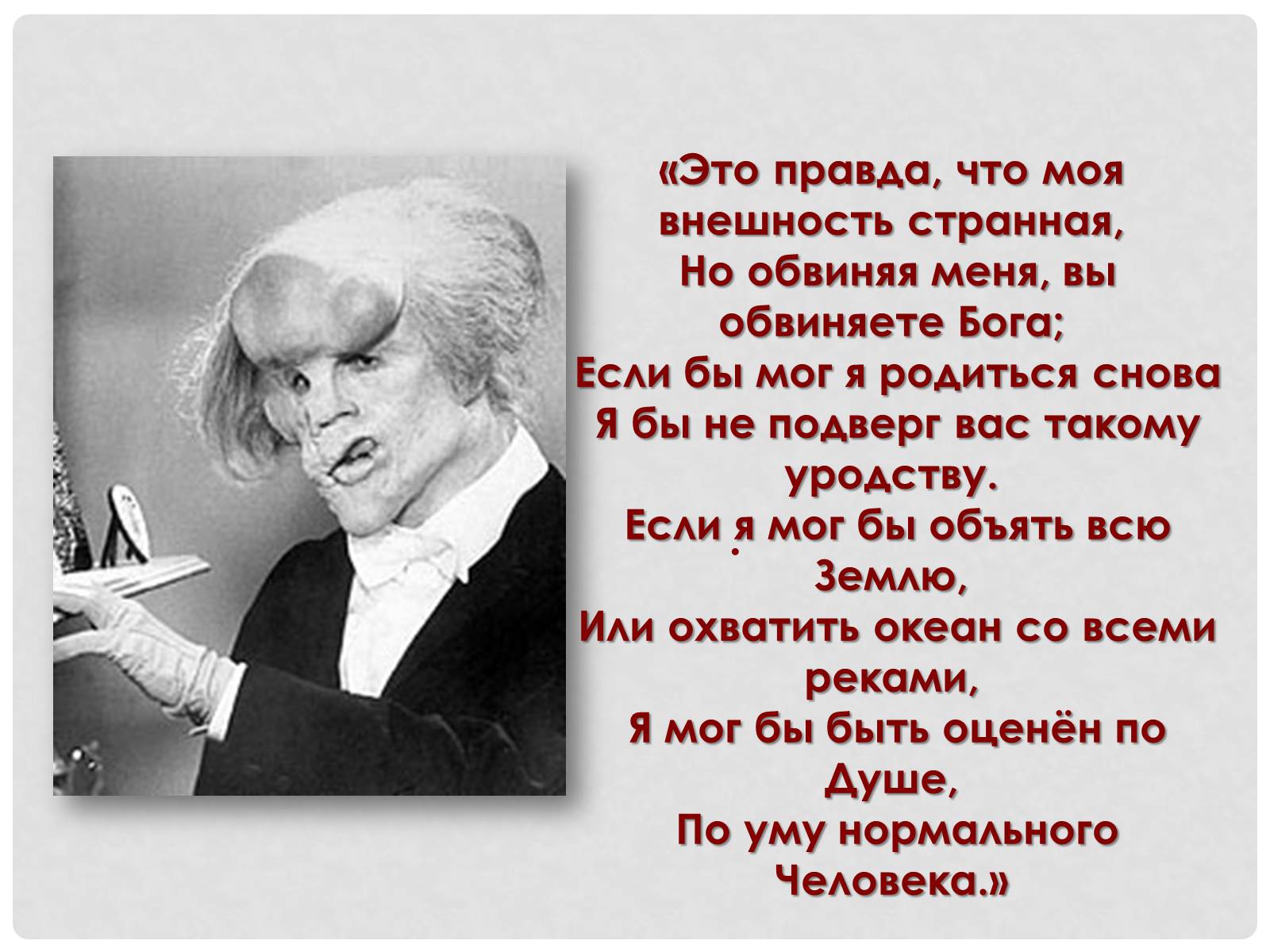 Презентація на тему «Спадкова хвороба людини=слона» - Слайд #7