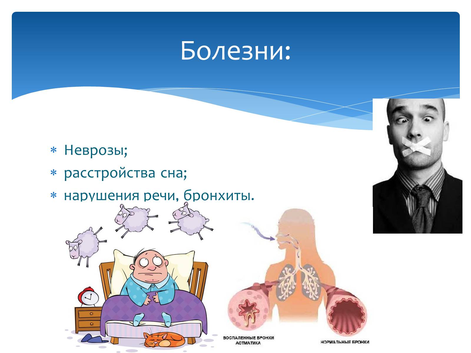 Презентація на тему «Здоровье по зодиакам» - Слайд #14