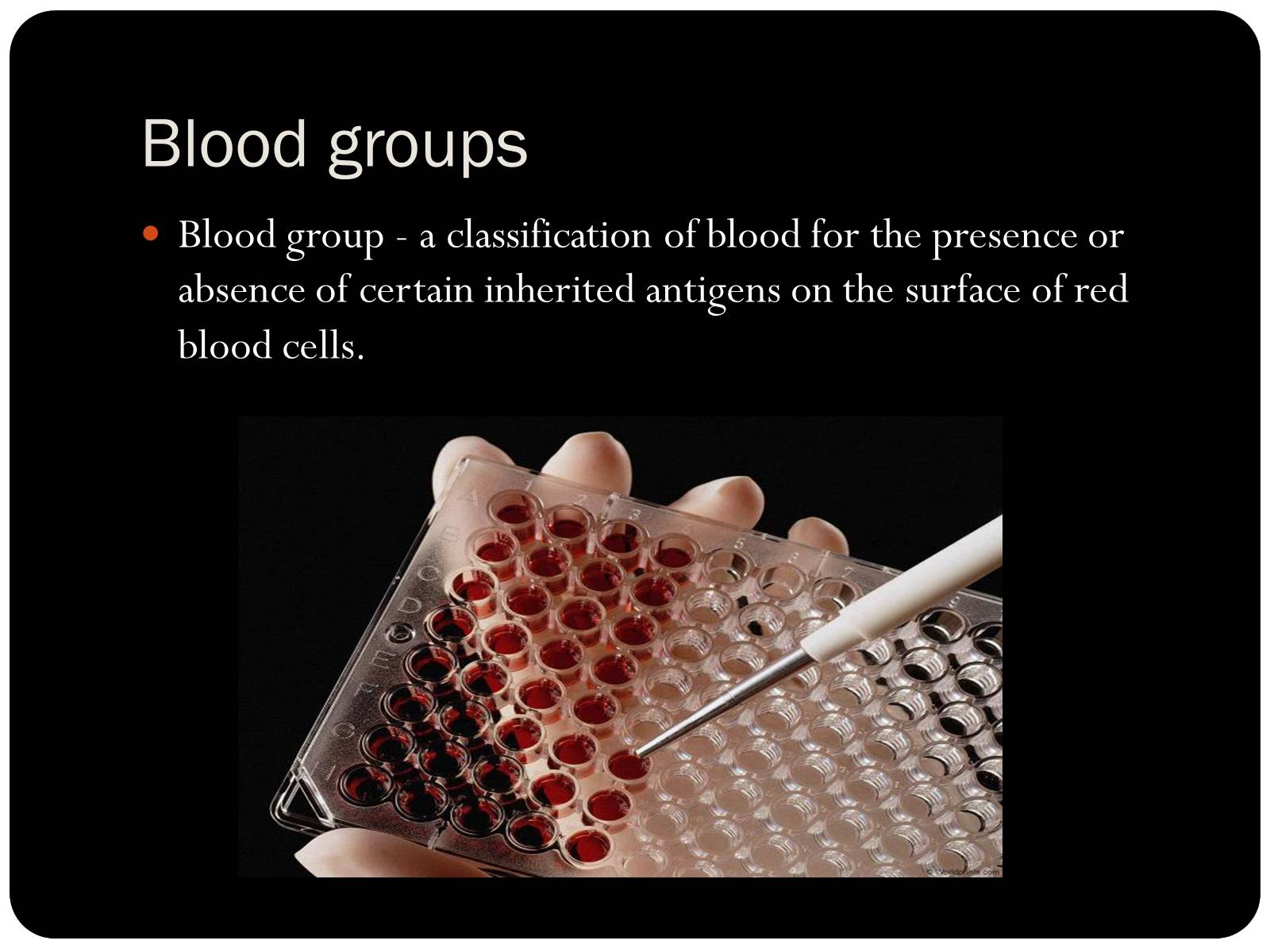Презентація на тему «Blood» - Слайд #7
