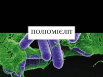 Презентація на тему «Поліомієліт» (варіант 2)