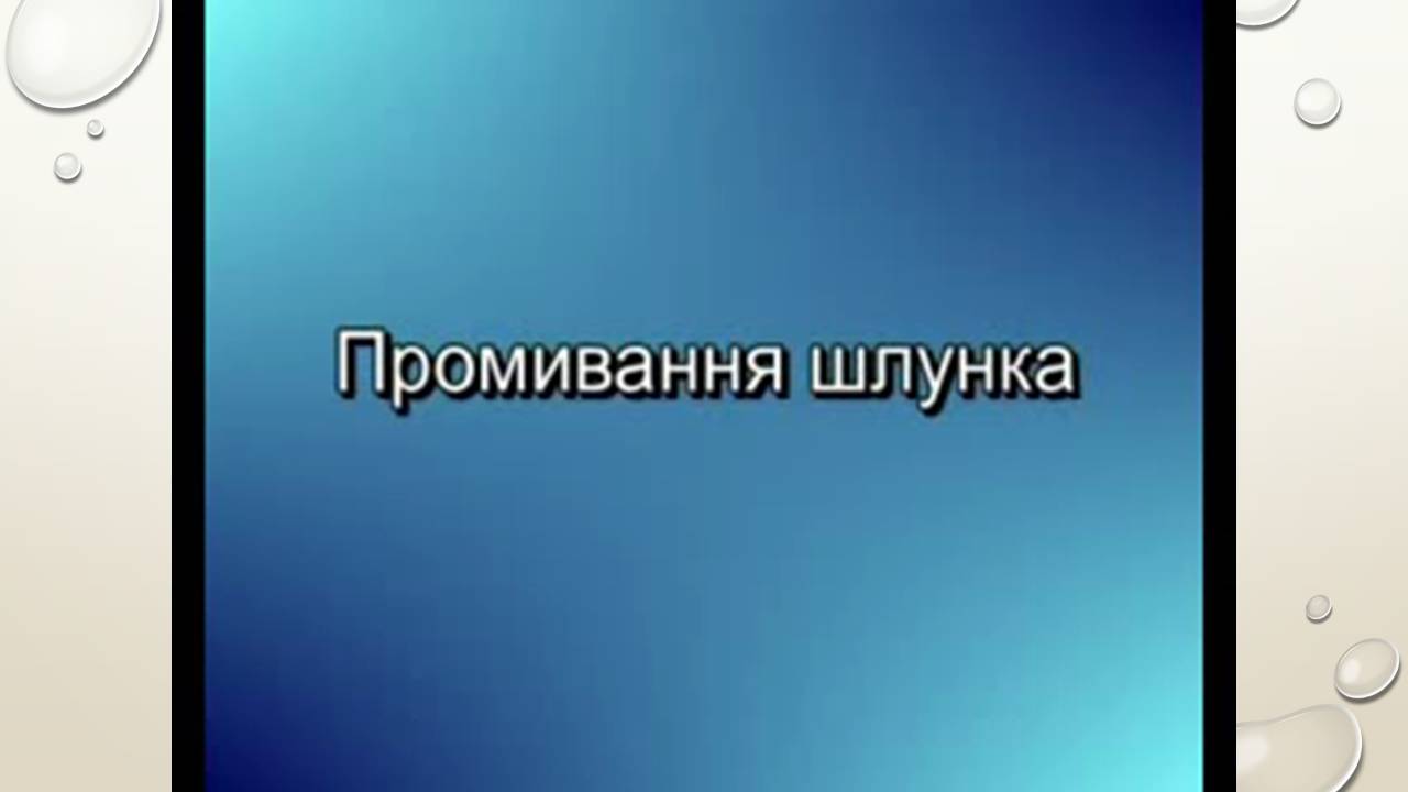 Презентація на тему «Перша допомога при захворюваннях шлунково-кишкового тракту та сечовивідної системи» - Слайд #17