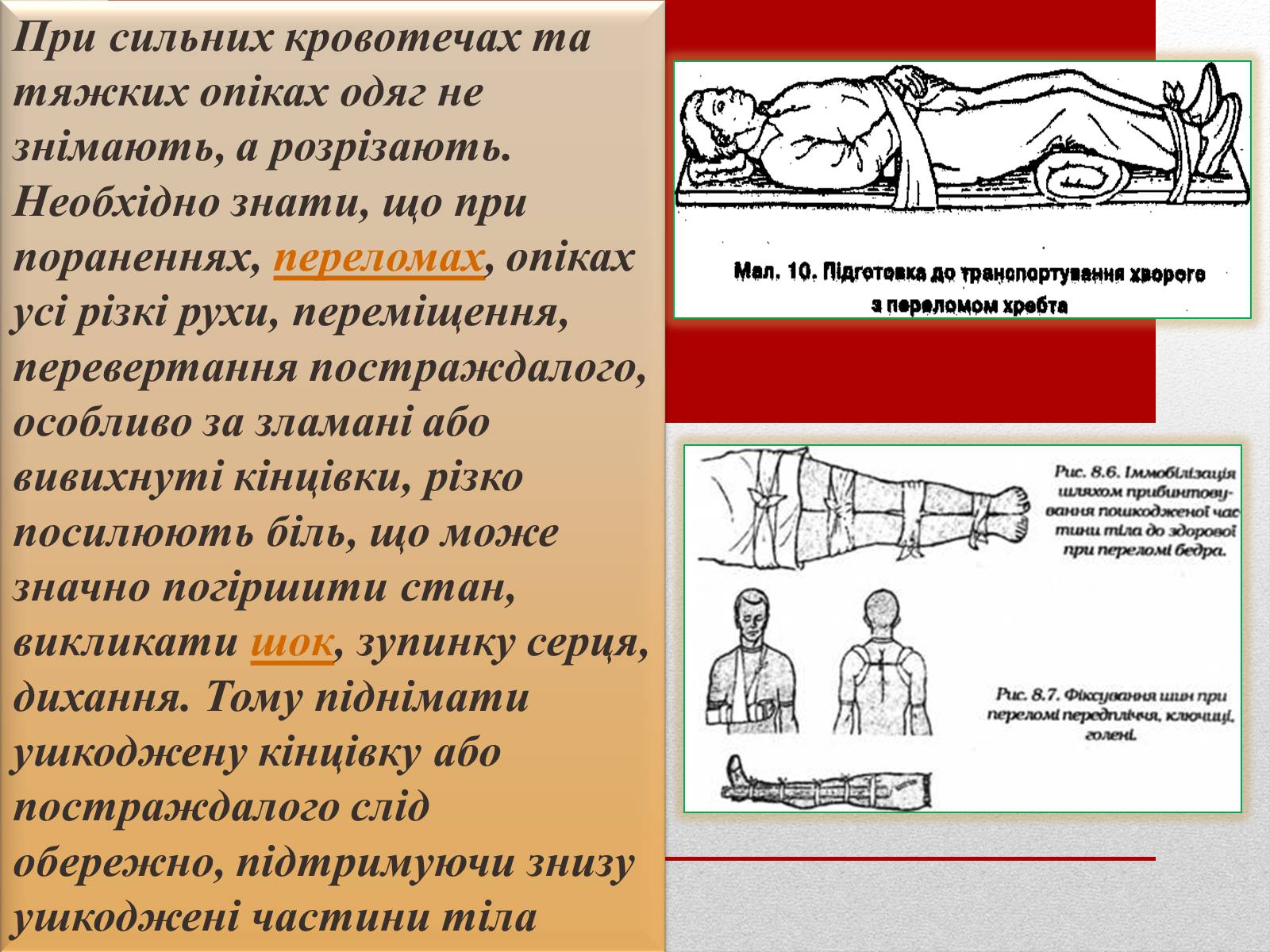 Презентація на тему «Основні способи реанімації і транспортування постраждалого» - Слайд #14