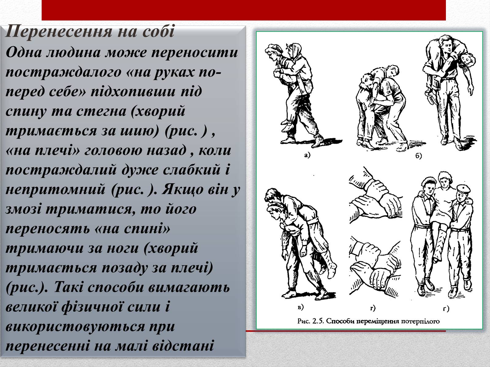 Презентація на тему «Основні способи реанімації і транспортування постраждалого» - Слайд #18