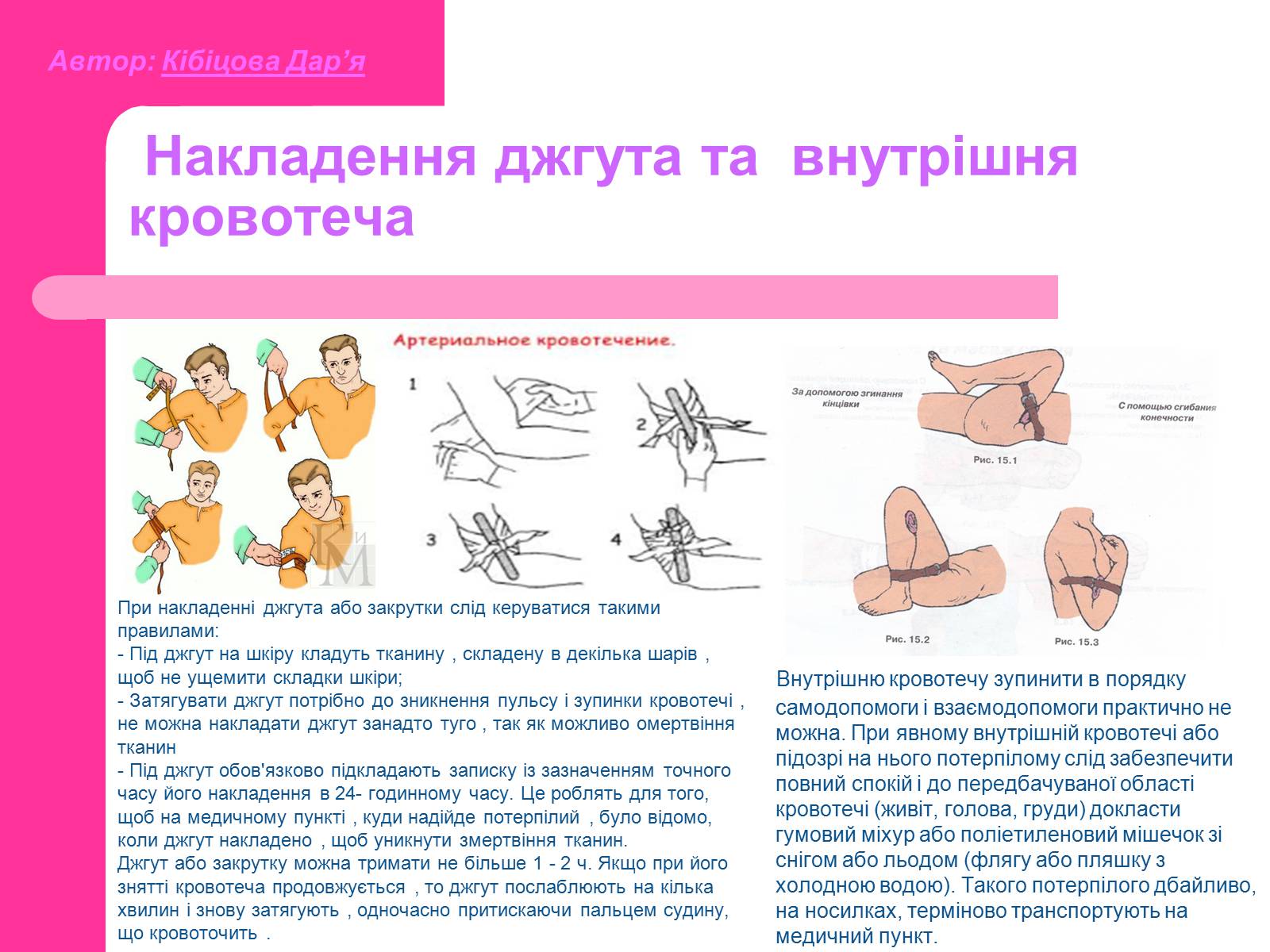 Презентація на тему «Основні принципи порятунку та захисту людей» - Слайд #10