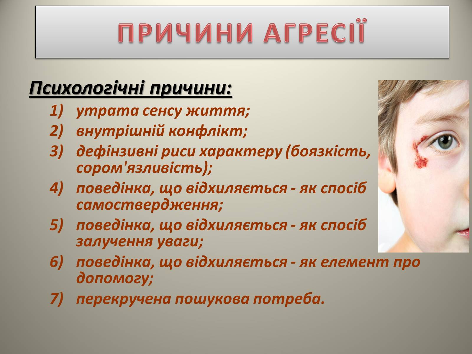 Презентація на тему «Причини і наслідки дитячої жорстокості» - Слайд #4