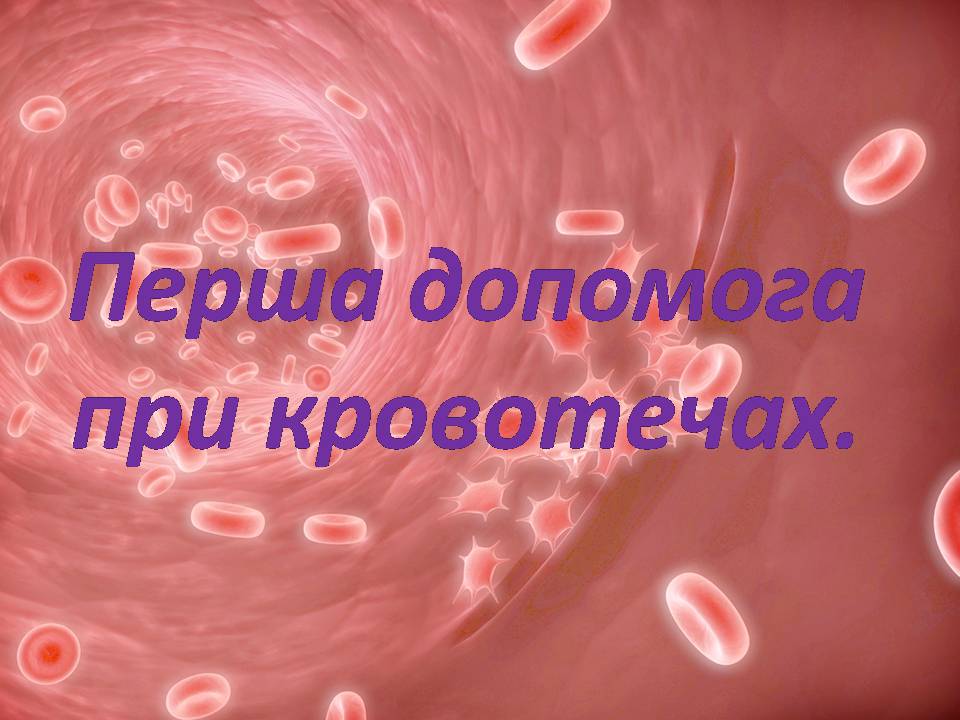 Презентація на тему «Перша допомога при кровотечах» (варіант 2) - Слайд #2