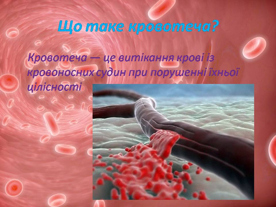 Презентація на тему «Перша допомога при кровотечах» (варіант 2) - Слайд #4