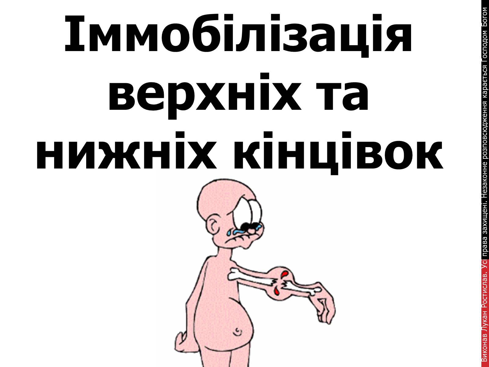 Презентація на тему «Іммобілізація верхніх та нижніх кінцівок» - Слайд #1