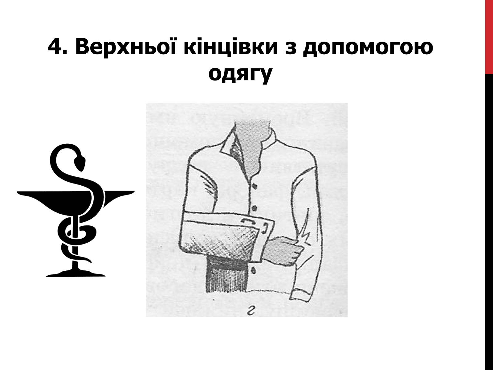 Презентація на тему «Іммобілізація верхніх та нижніх кінцівок» - Слайд #8