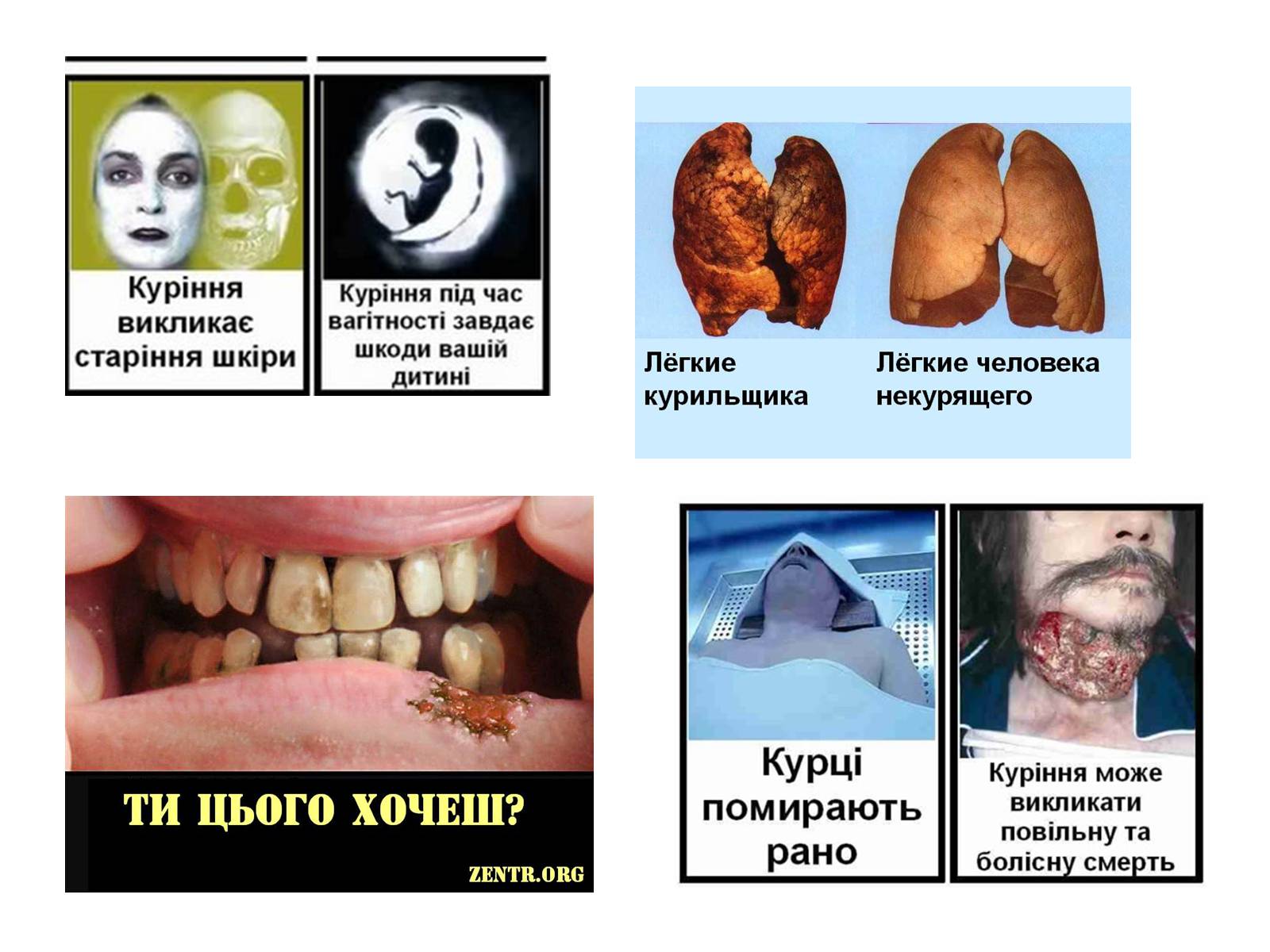 Презентація на тему «Правда про куріння» - Слайд #8